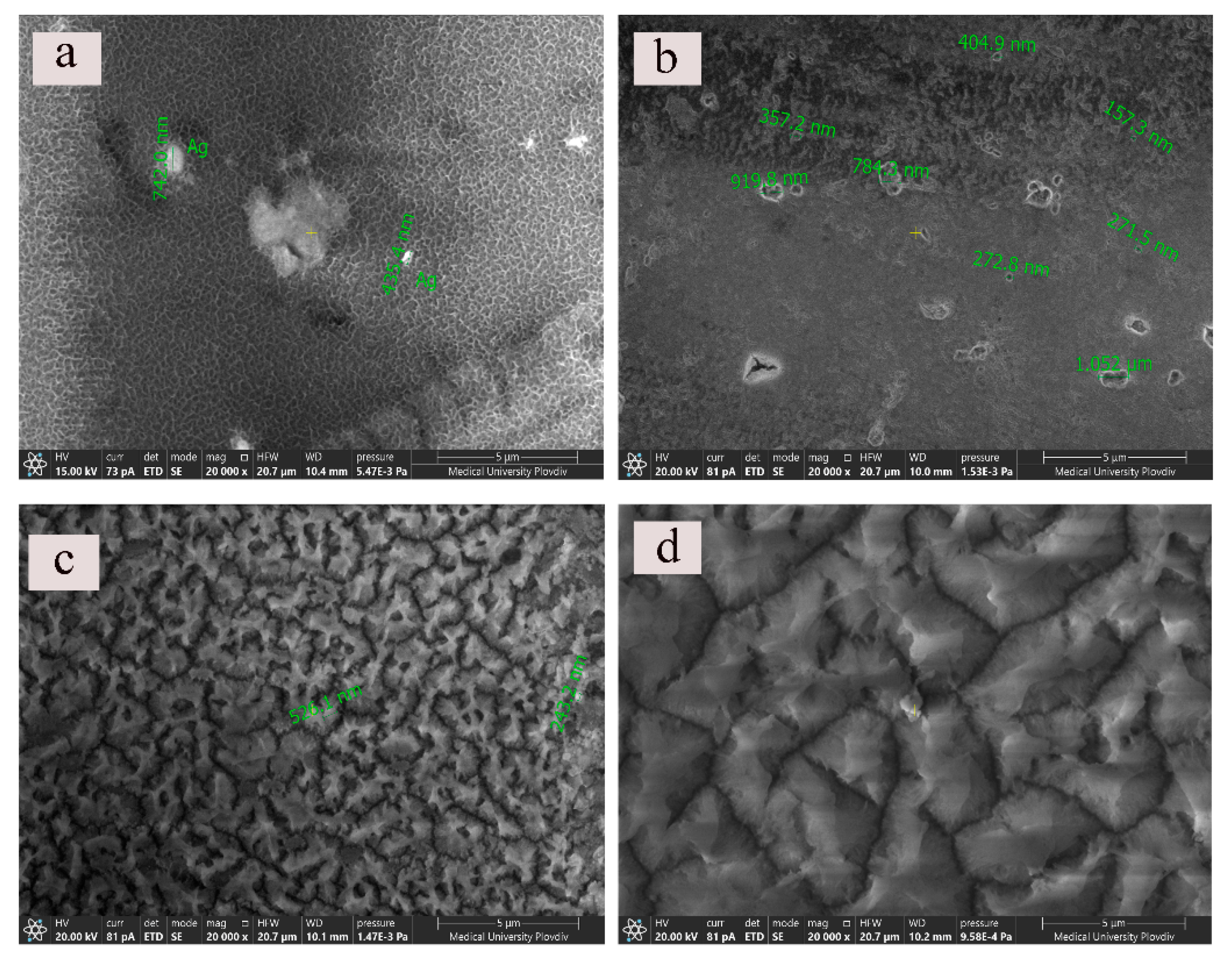 Metals 12 00051 g003 550