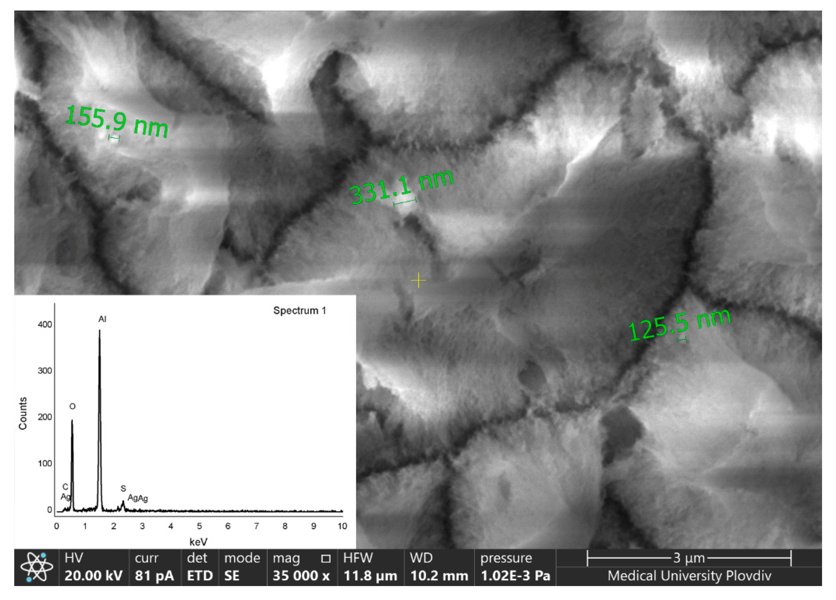 Metals 12 00051 g004 550