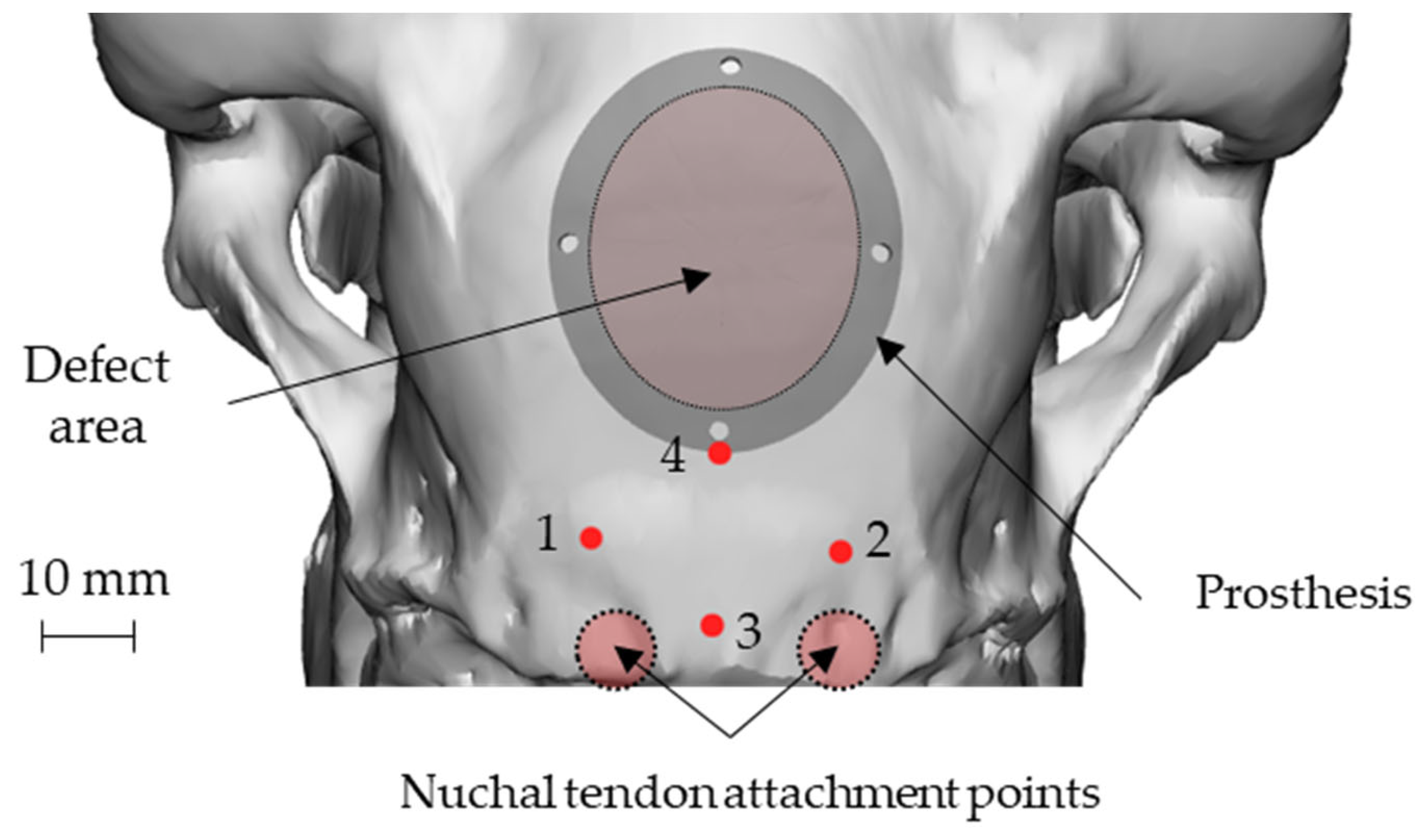 Metals 12 00293 g003 Metals 12 00293 g003
