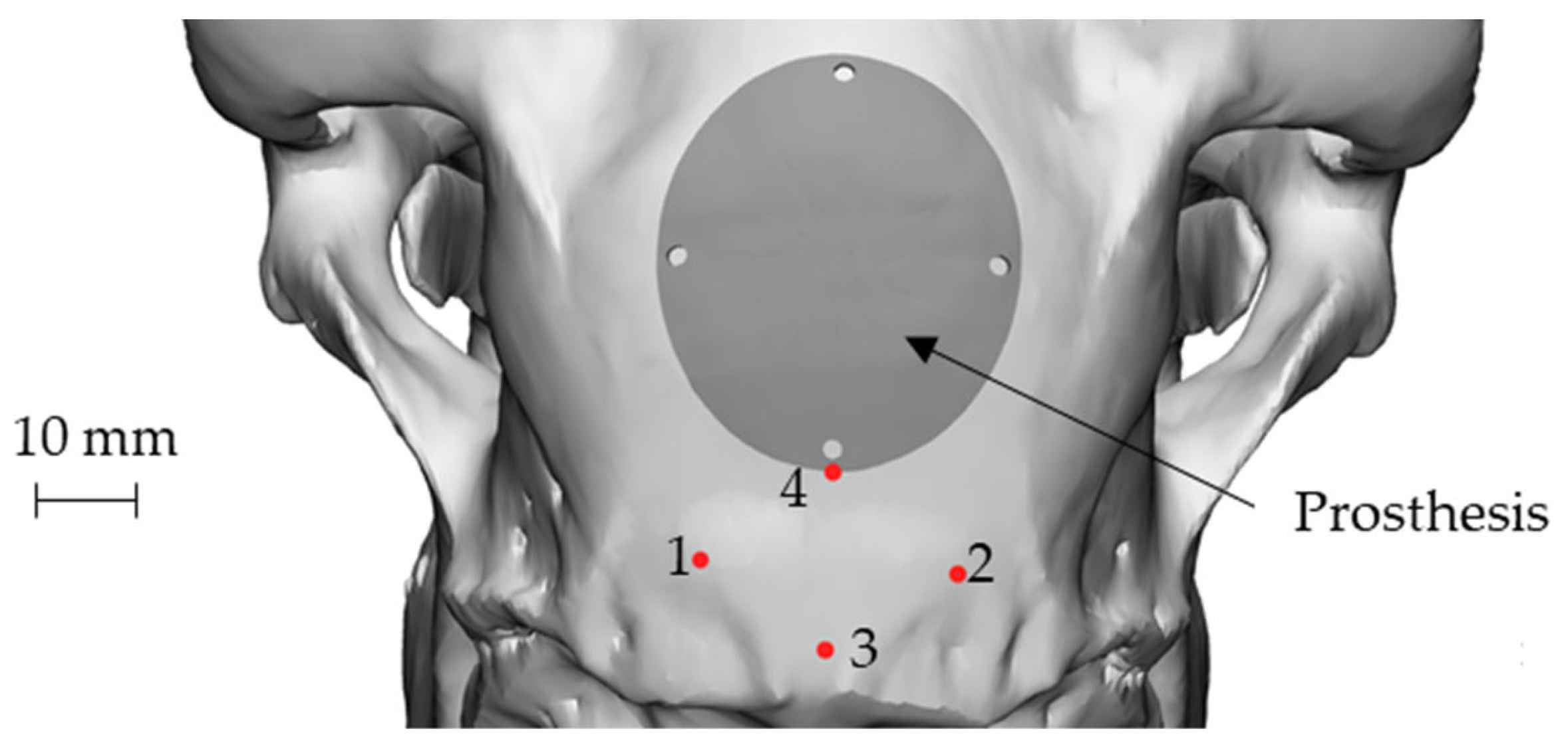 Metals 12 00293 g006 Metals 12 00293 g006