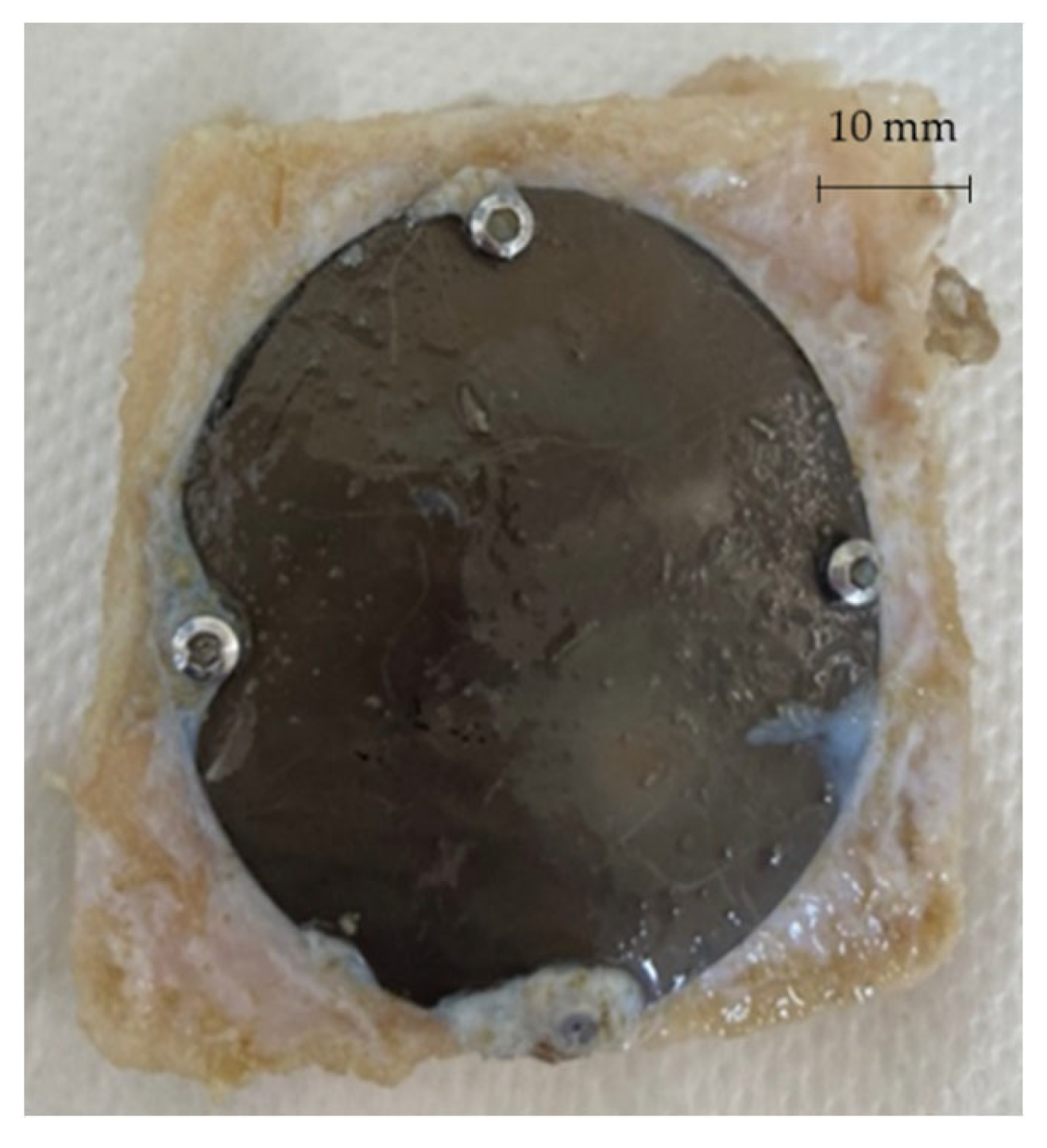 Metals 12 00293 g020 Metals 12 00293 g020