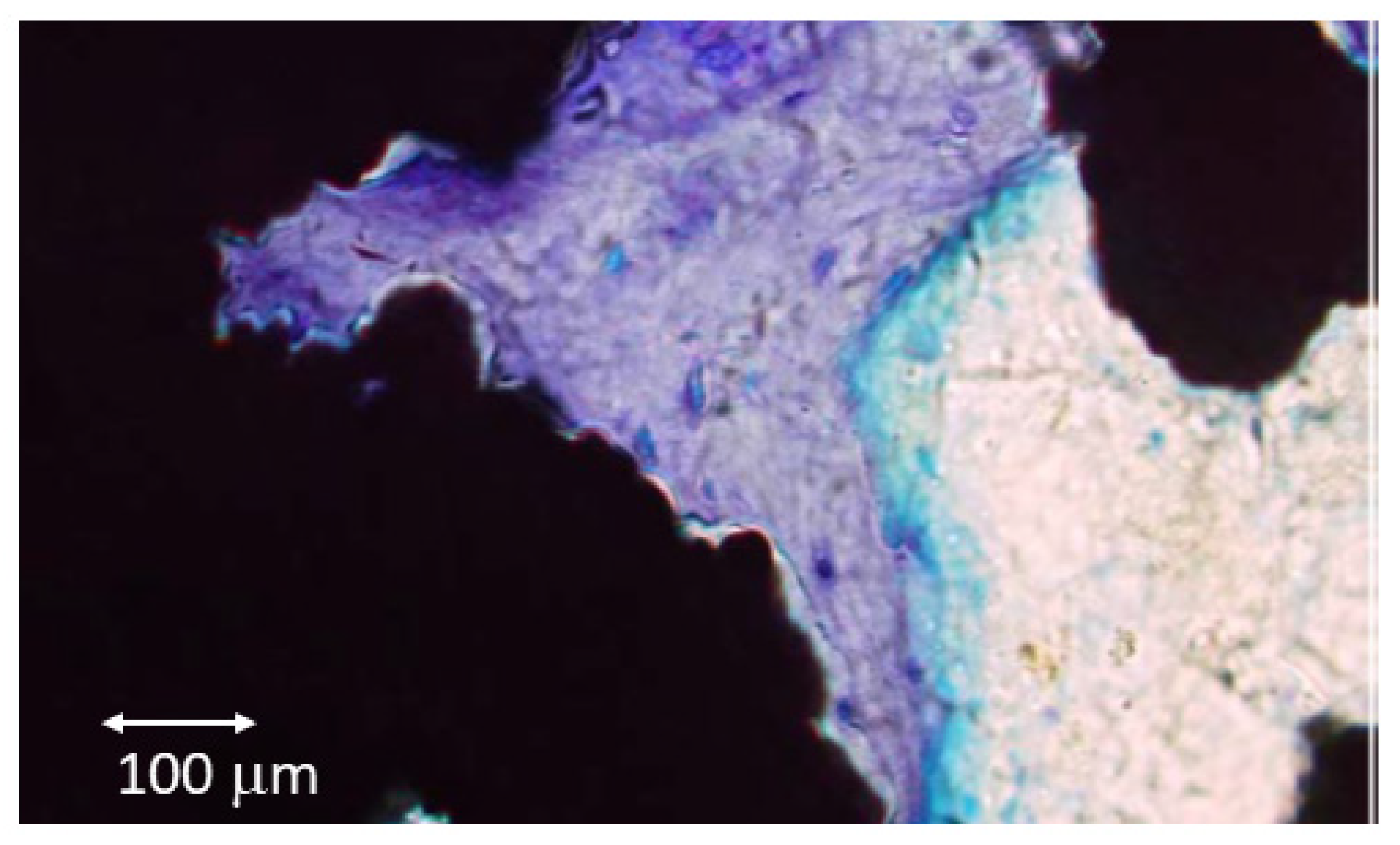 Metals 12 00327 g007