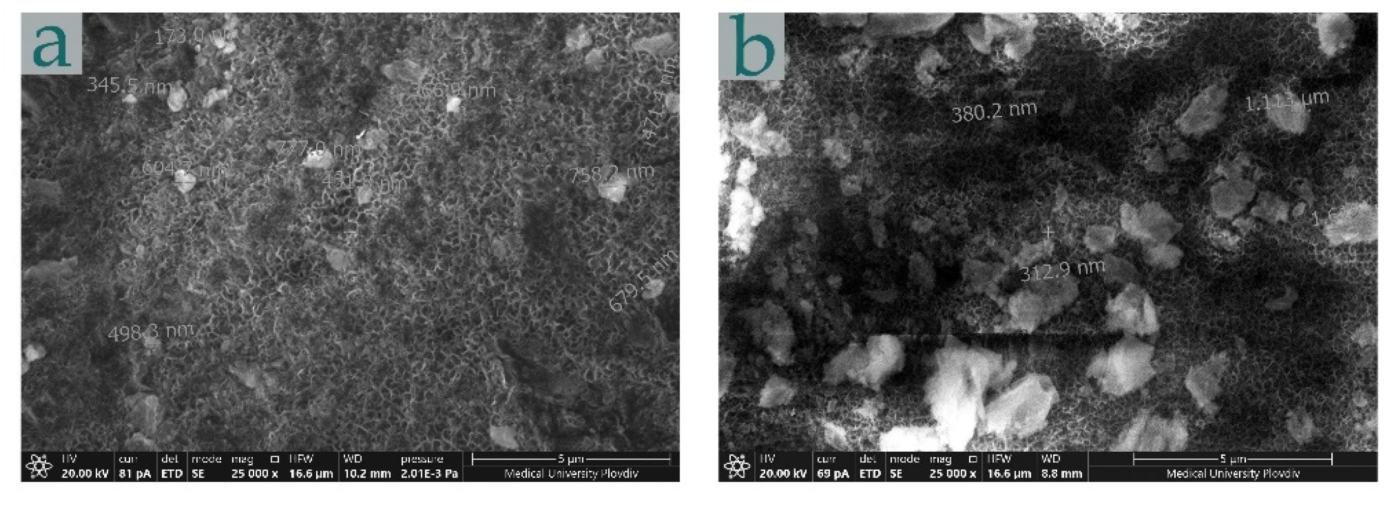 Metals 12 00474 g005 550