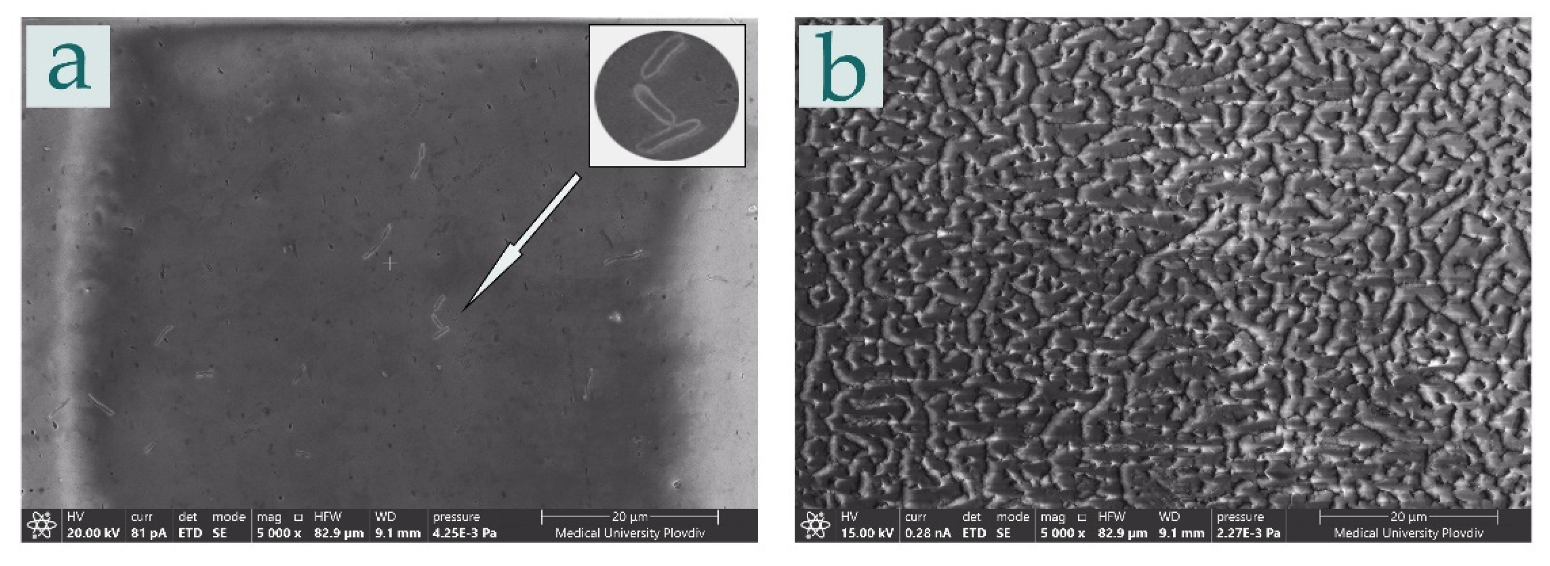 Metals 12 00474 g010 550