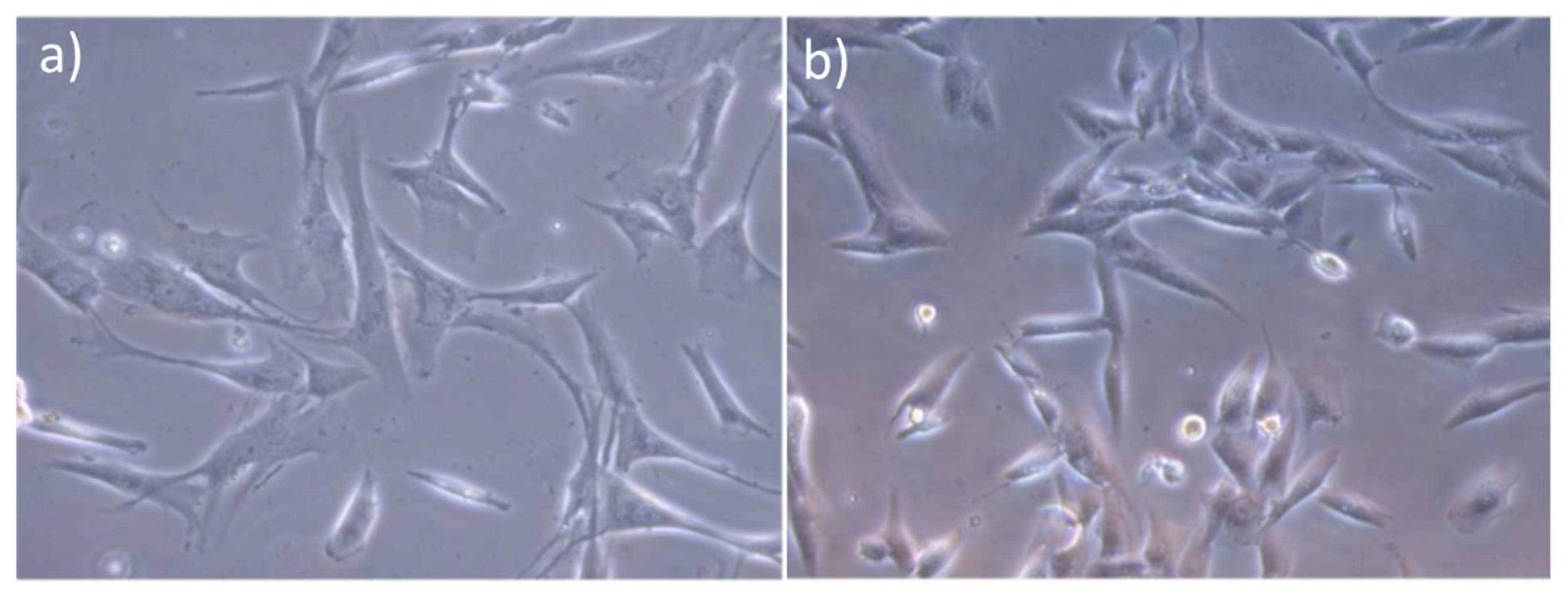 Metals 12 00476 g001 550