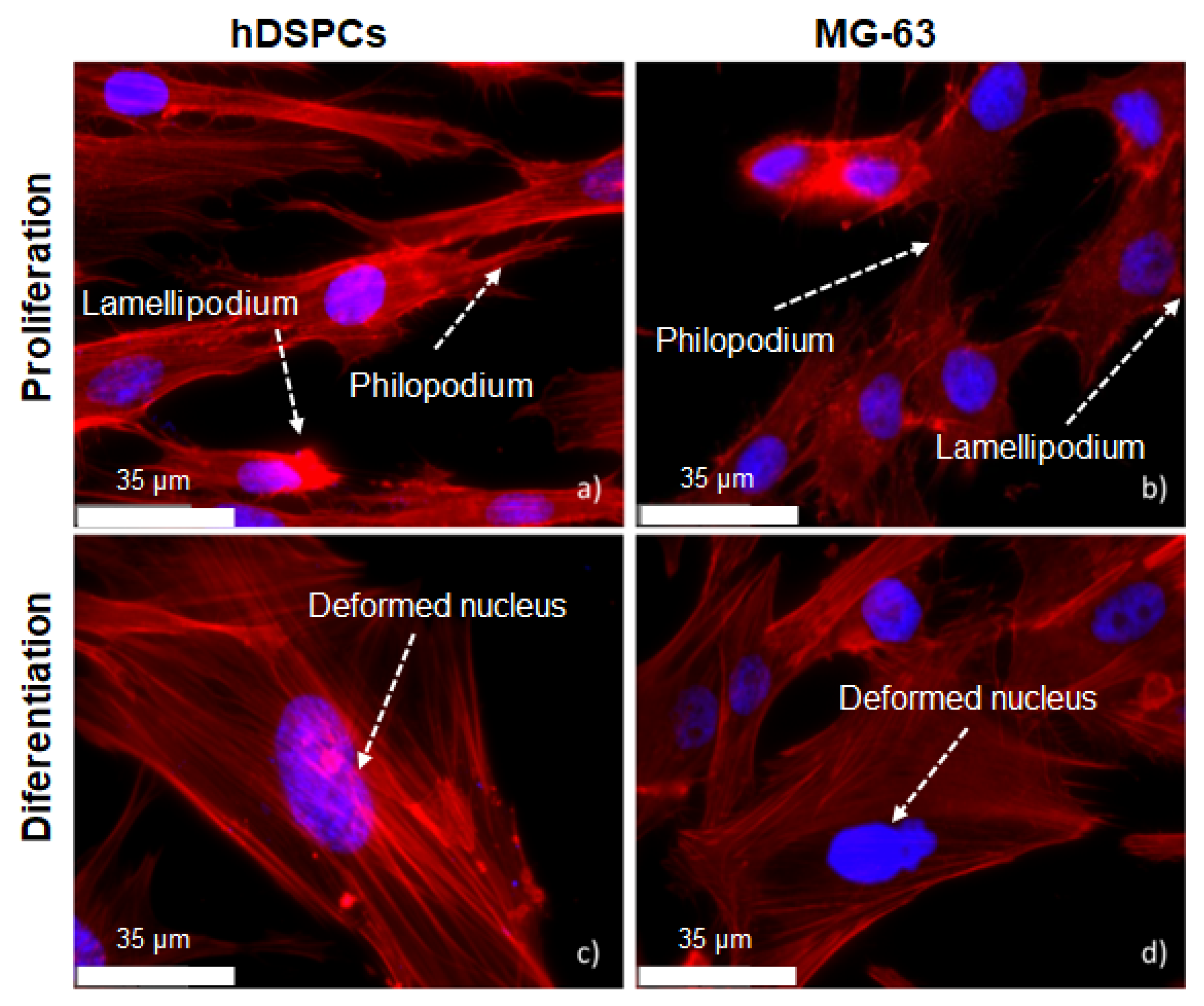 Metals 12 00476 g015 550