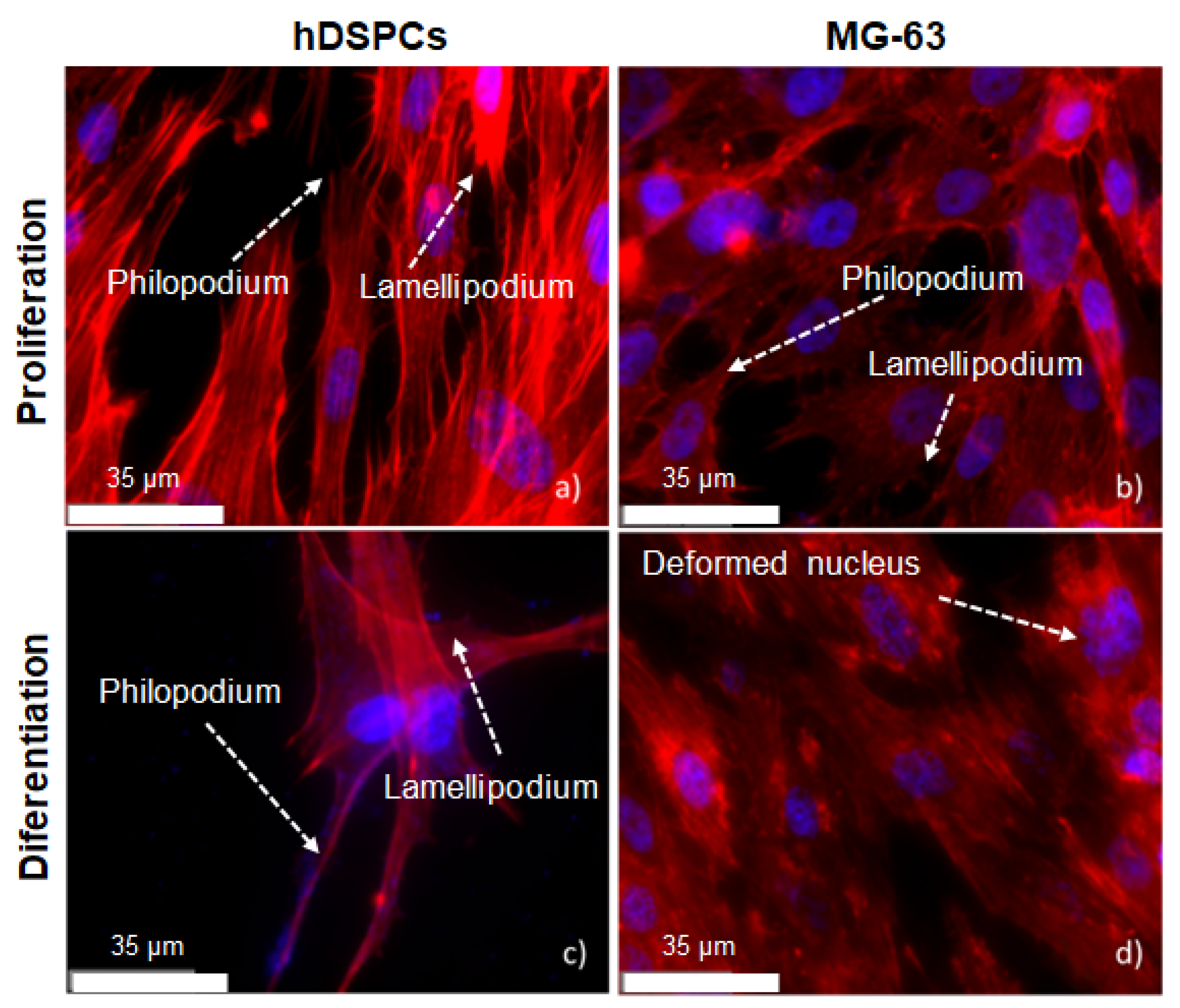 Metals 12 00476 g016 550