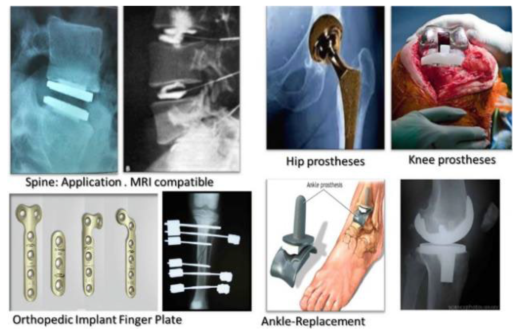 Metals 12 00829 g001 Metals 12 00829 g001