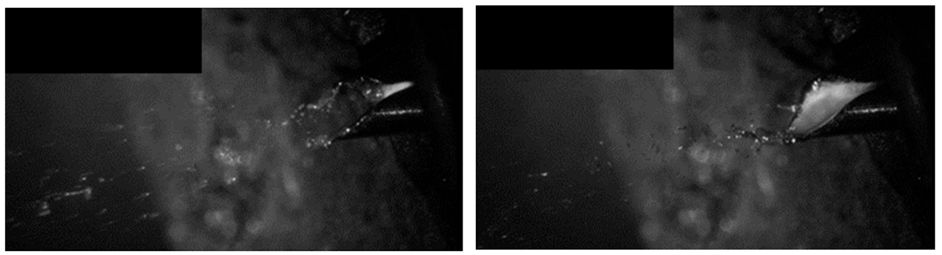 Metals 12 01347 g005 550