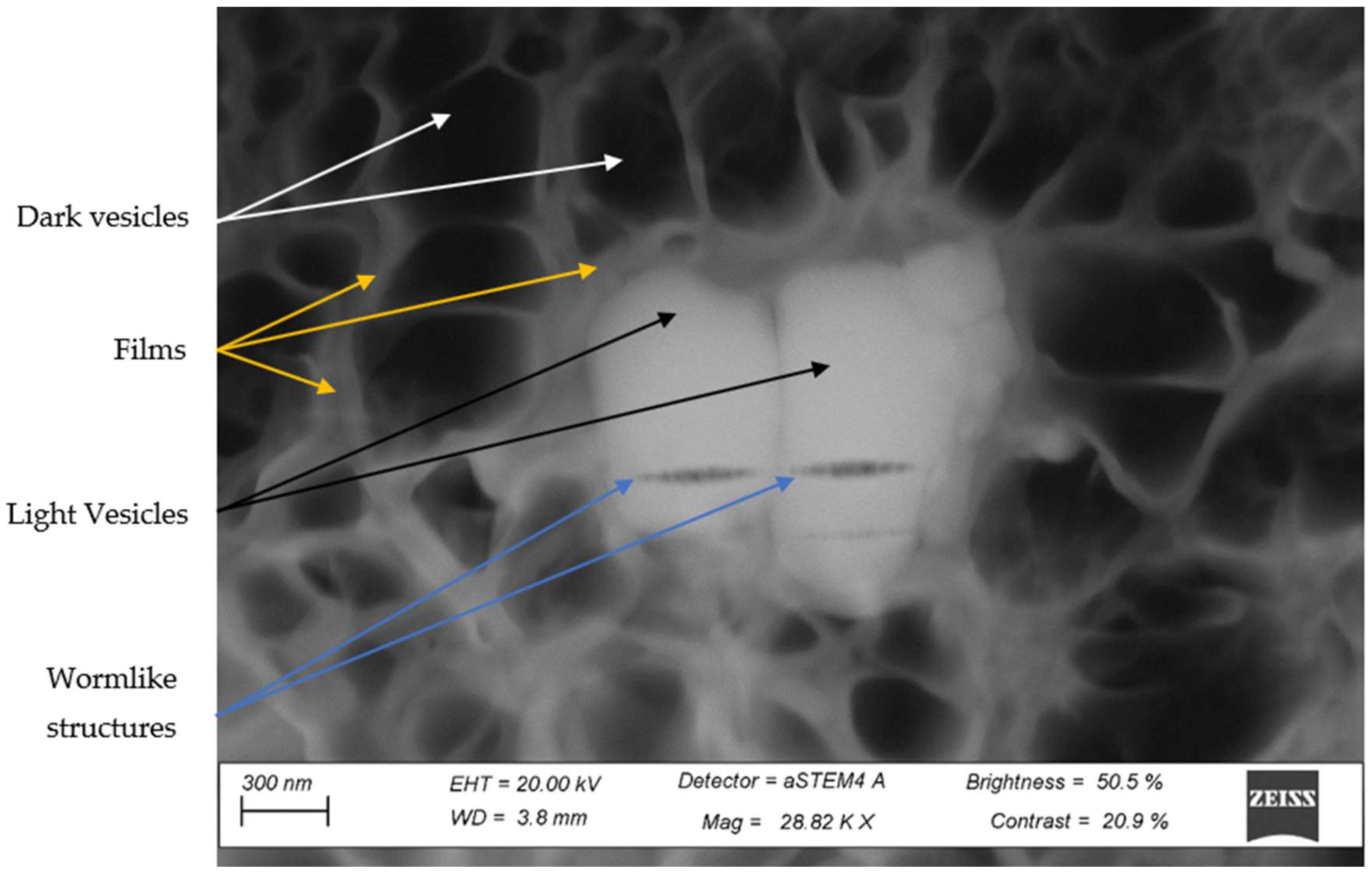 Metals 12 01400 g0a2