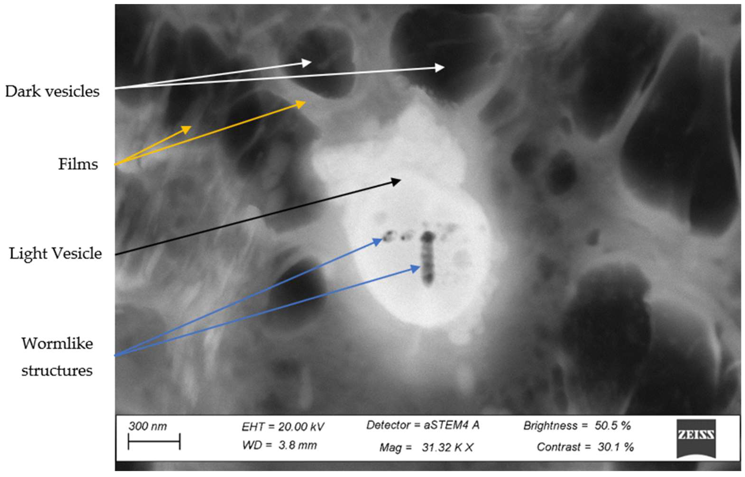Metals 12 01400 g0a3