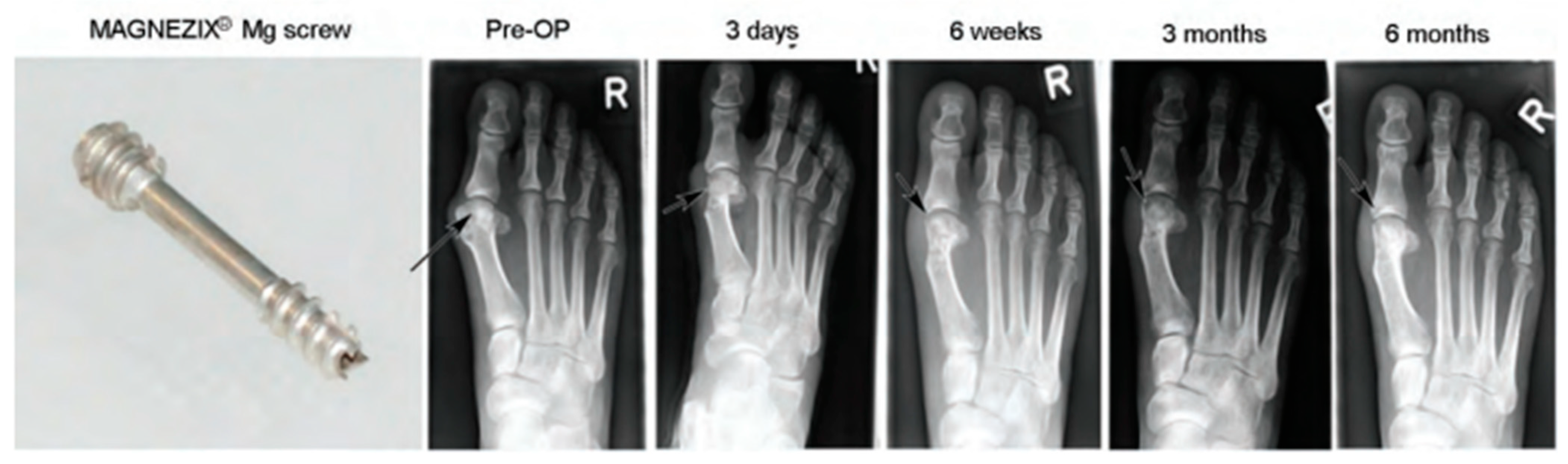 Metals 12 01500 g003