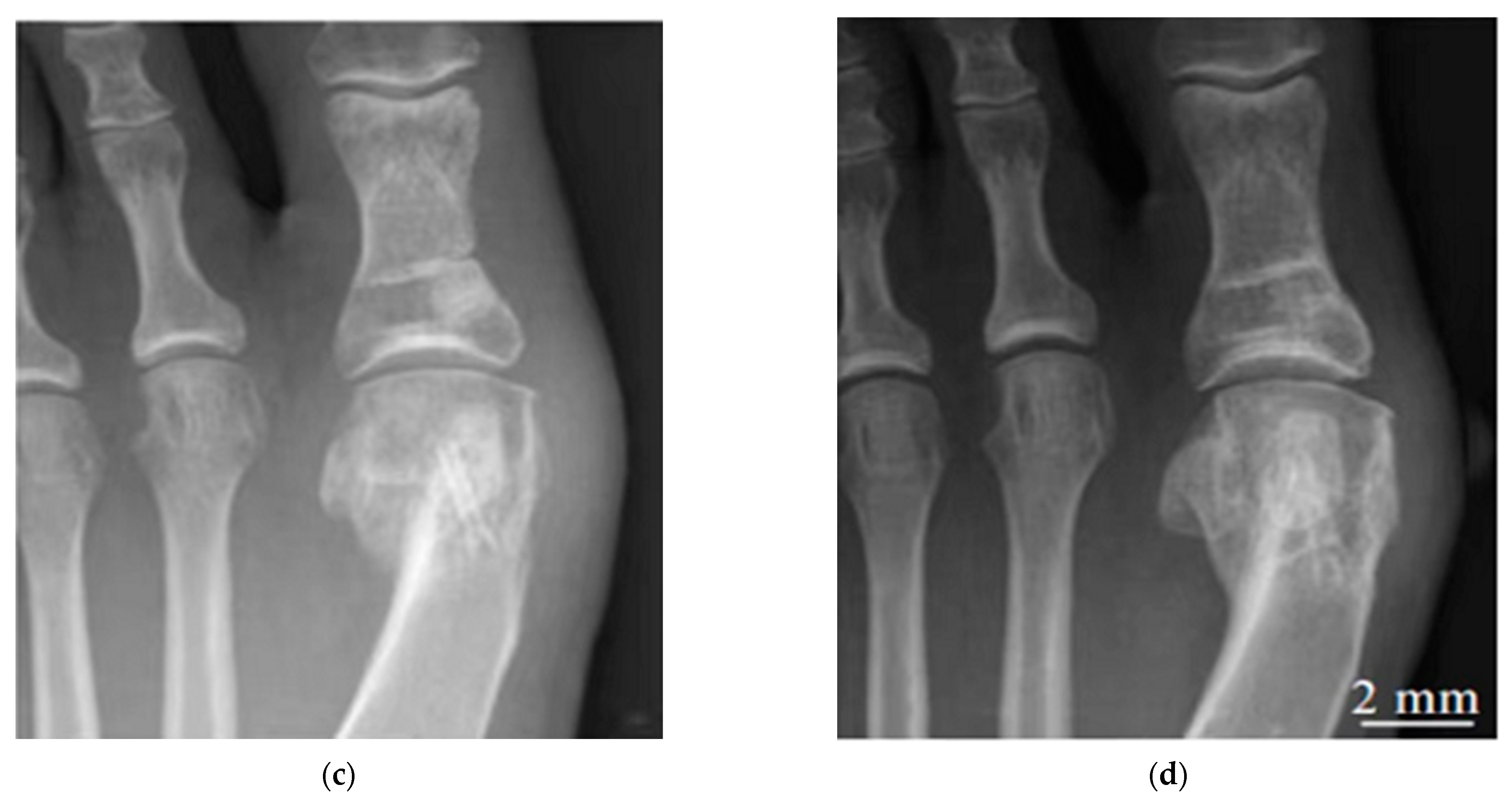 Metals 12 01500 g013b