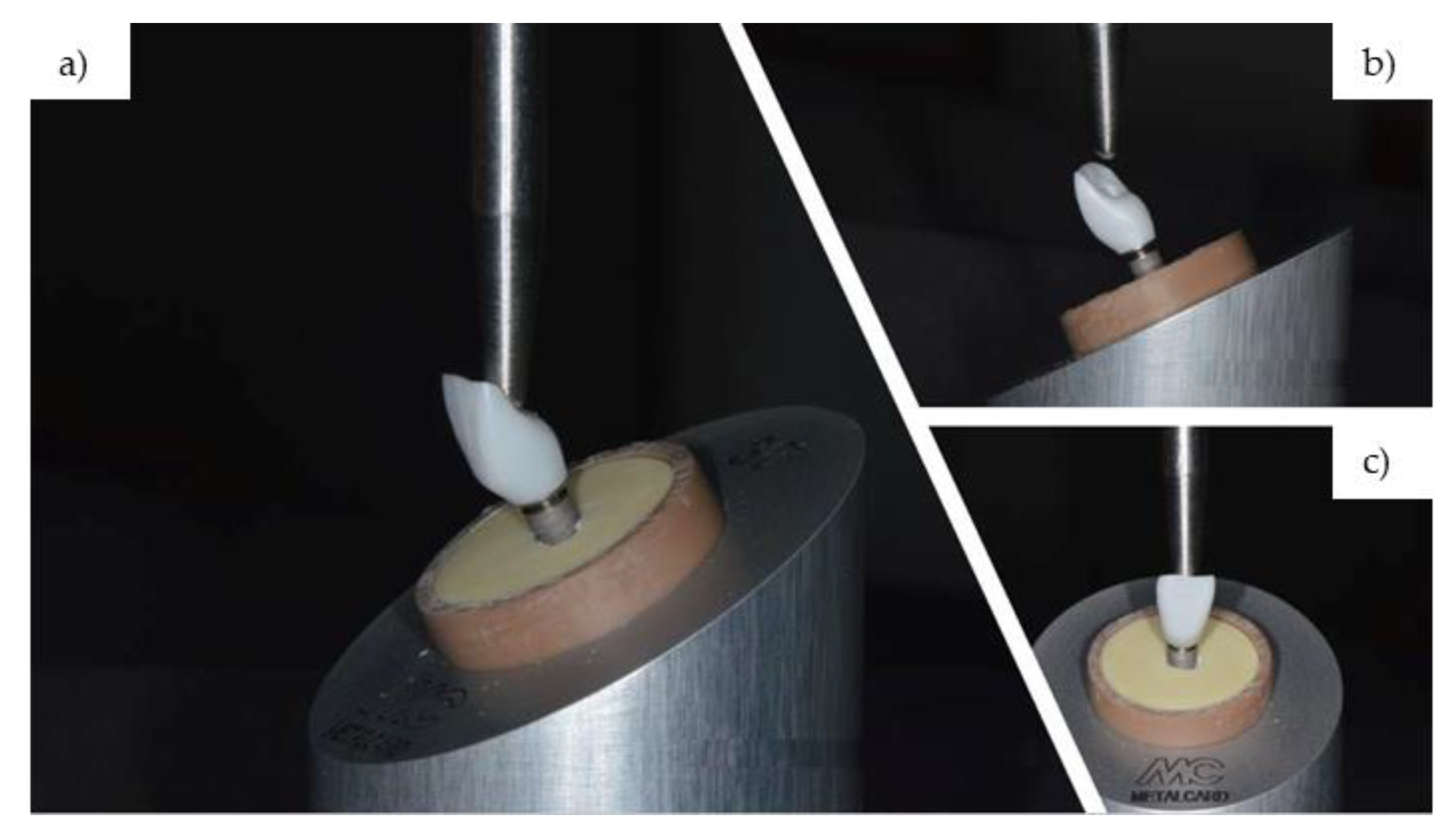 Influence of CAD/CAM Abutment Heights on the Biomechanical Behavior of ...
