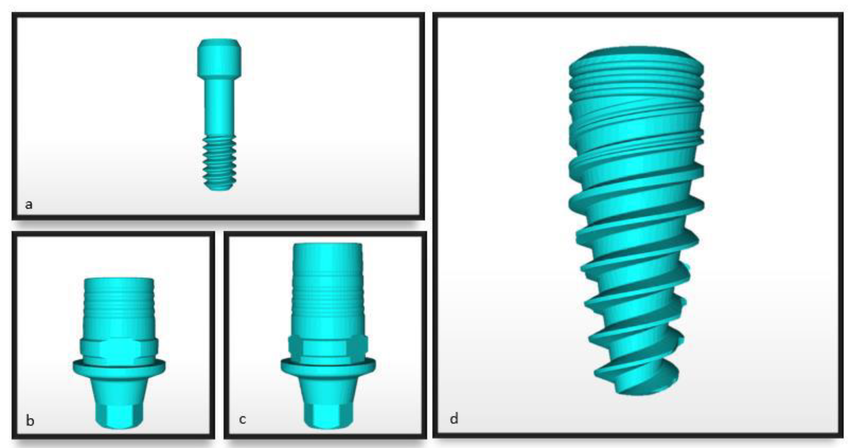 Influence of CAD/CAM Abutment Heights on the Biomechanical Behavior of ...
