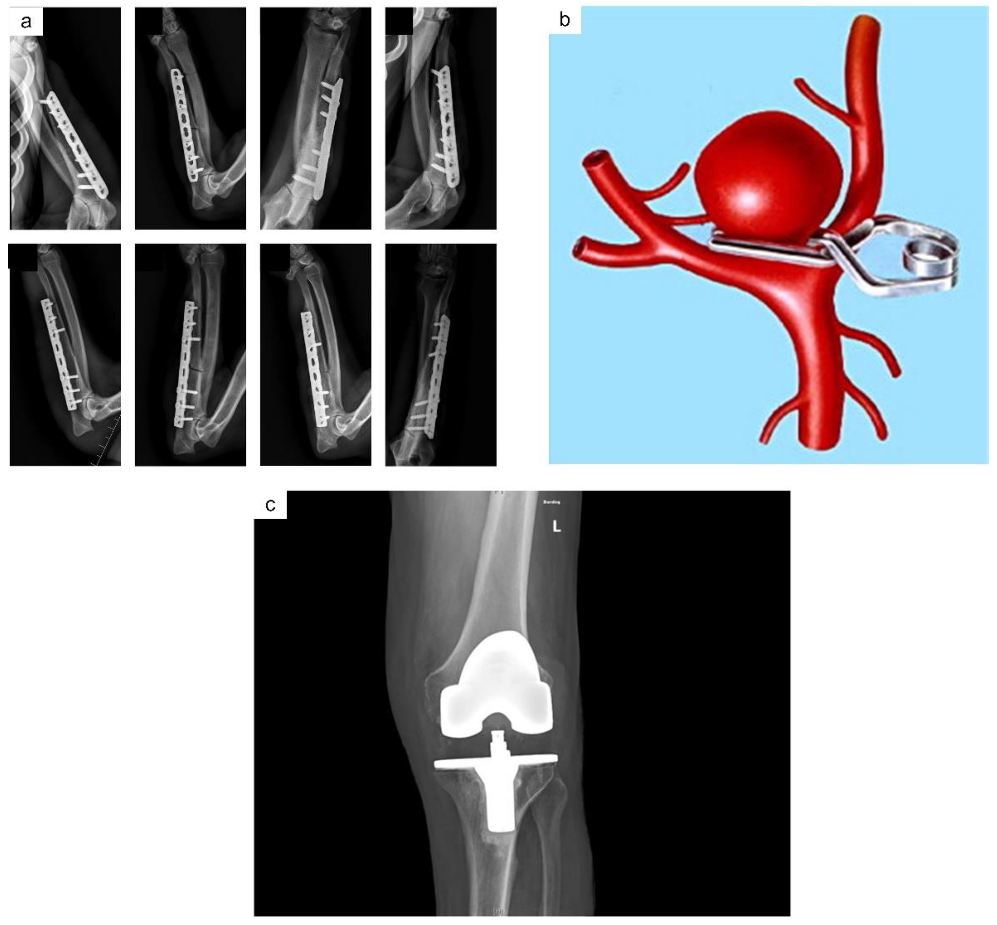 Metals 13 00194 g002 Metals 13 00194 g002