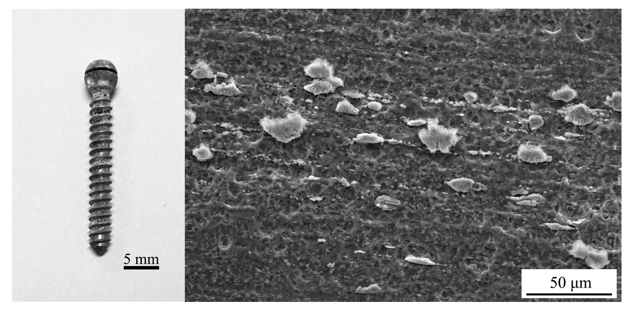 Metals 13 00352 g011