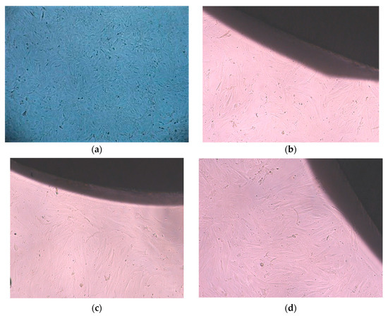 mmmmm Microstructure and Mechanical Properties of Biomedical Ti-Zr