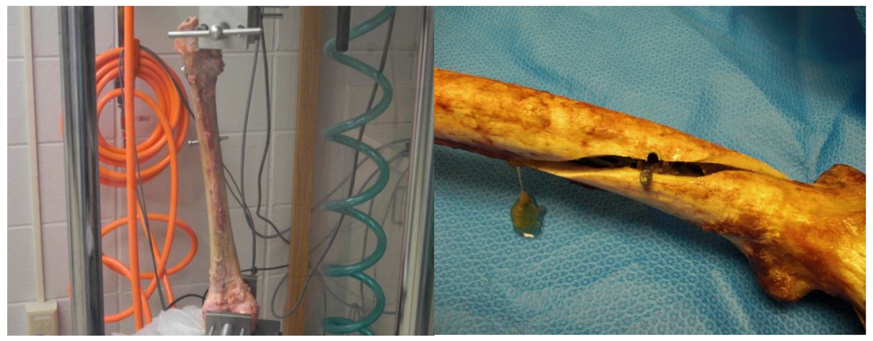 Metals 13 00509 g006