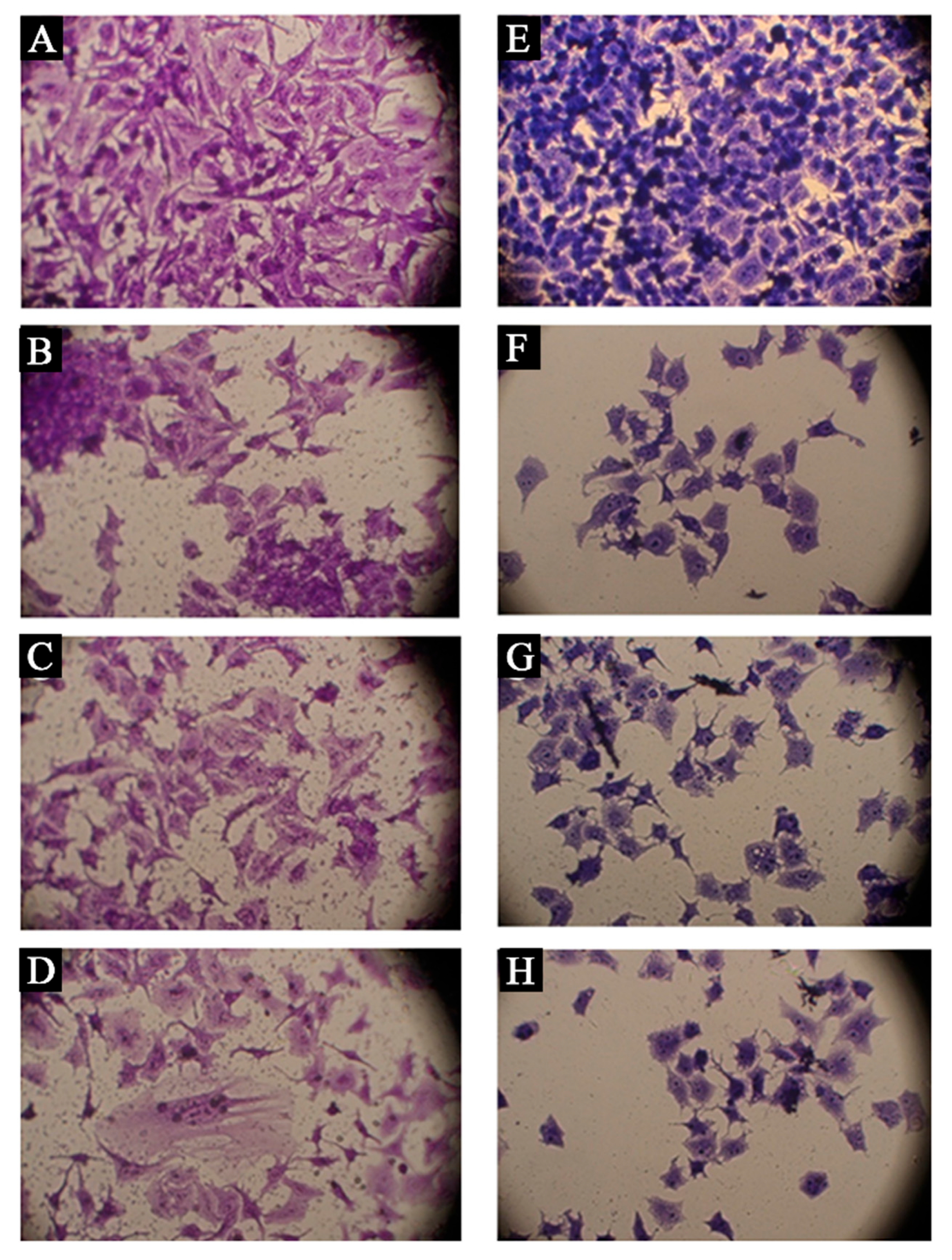 Metals 13 00735 g009