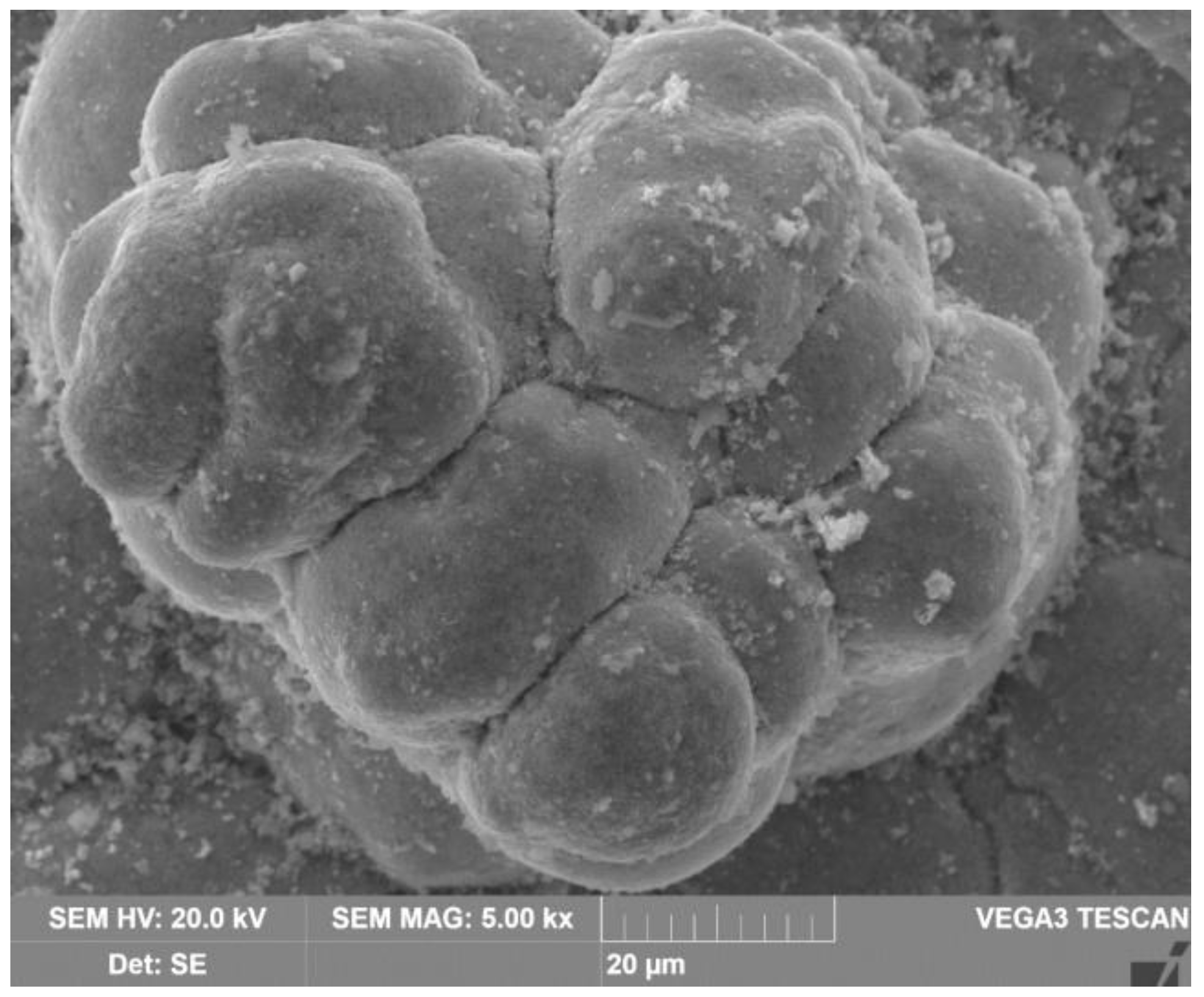 Metals 13 01502 g015