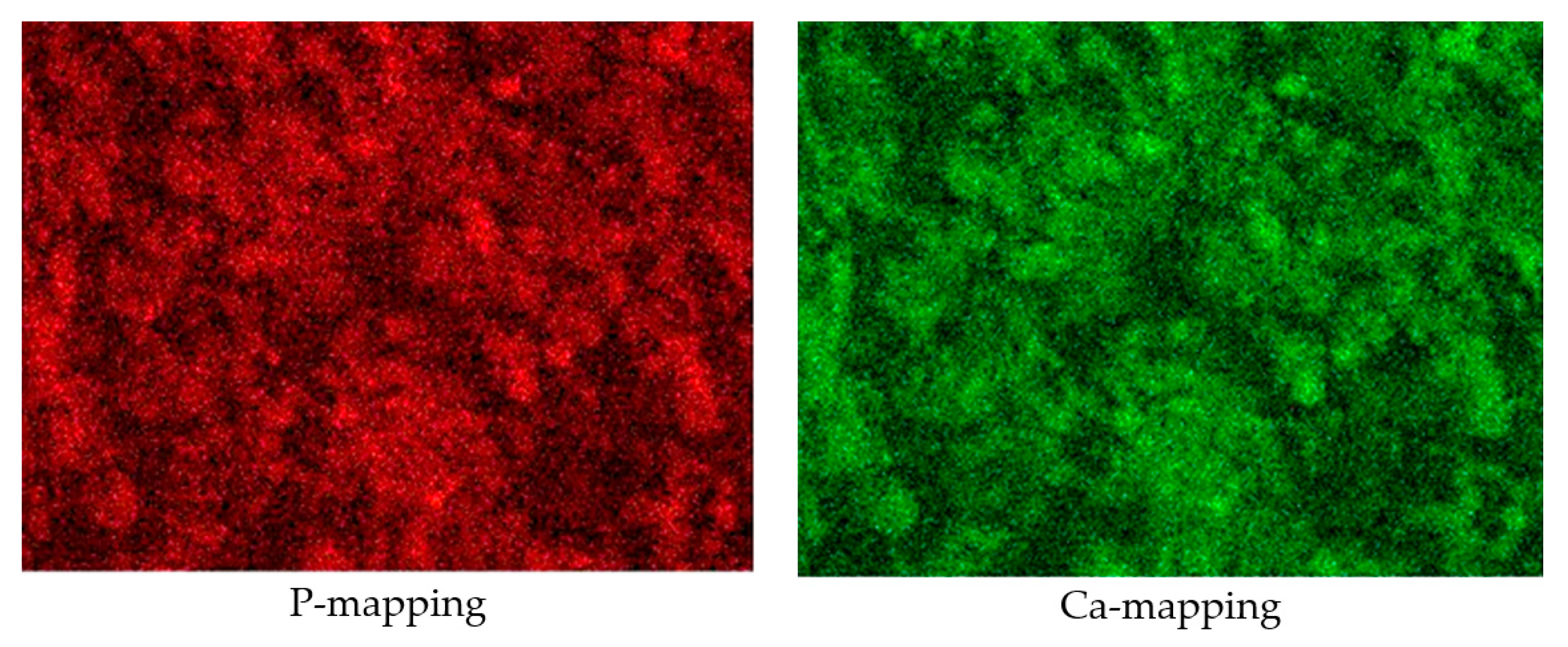 Metals 13 01828 g005b