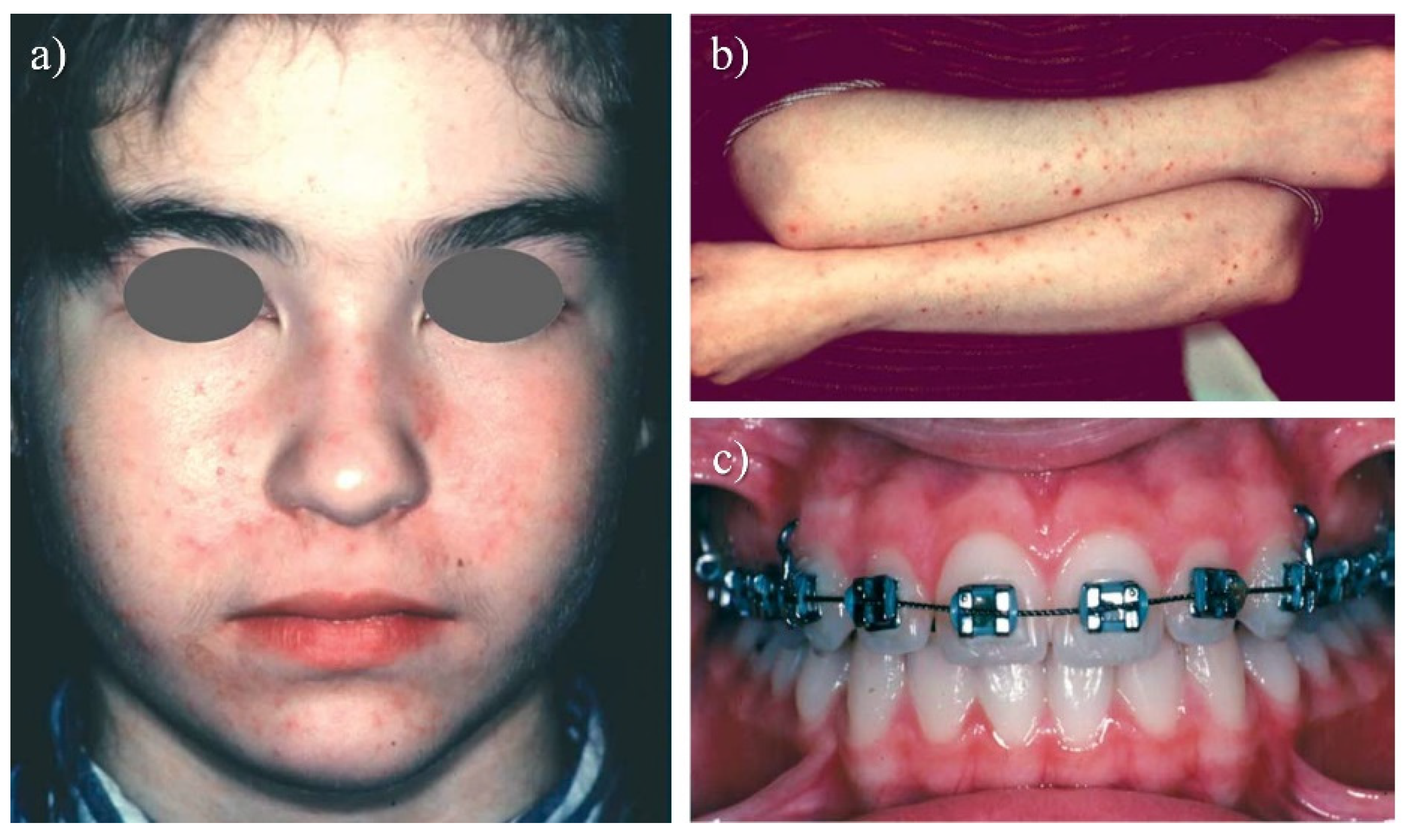 Metals 13 01955 g010