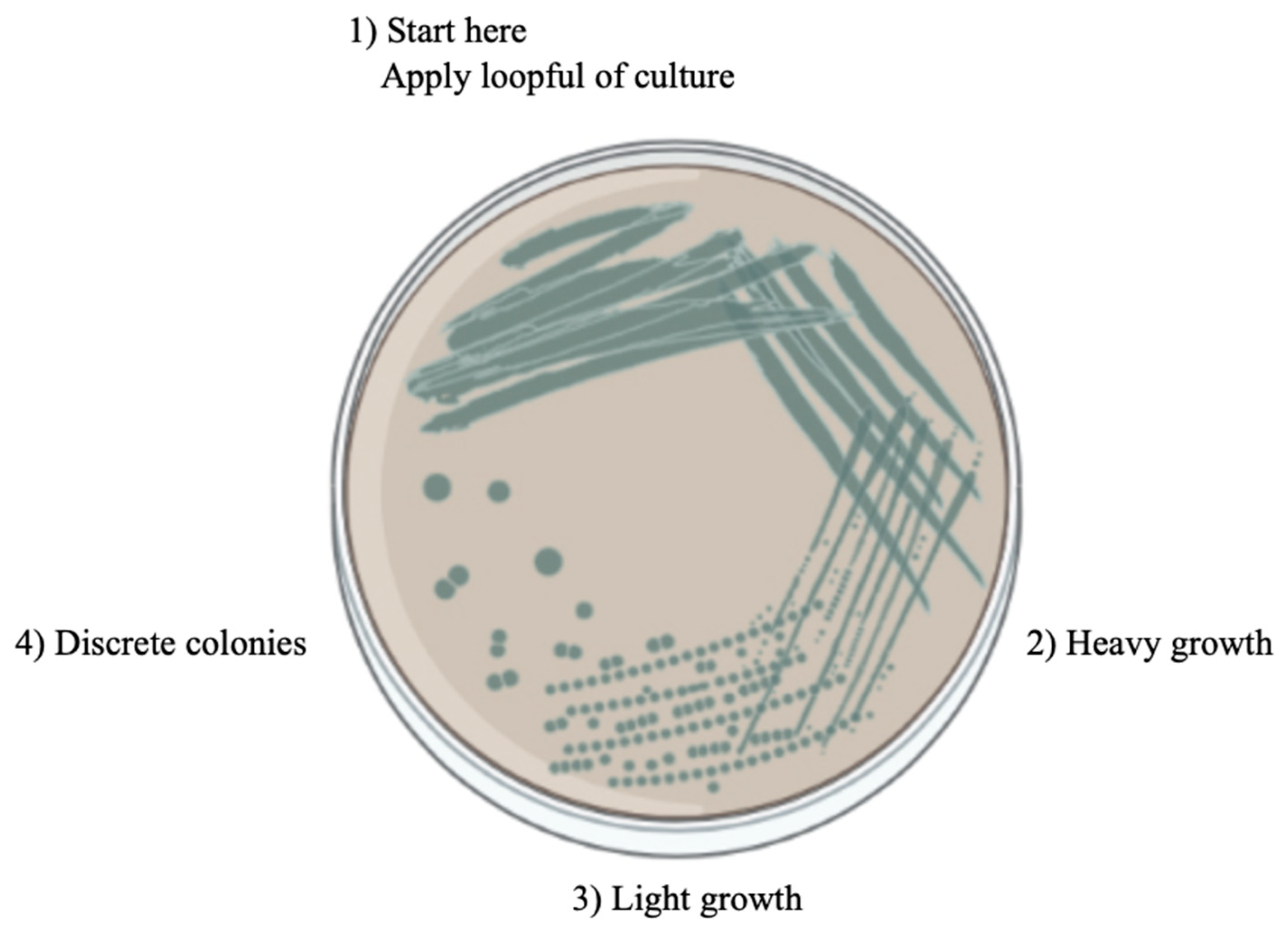 Metals 13 01974 g006