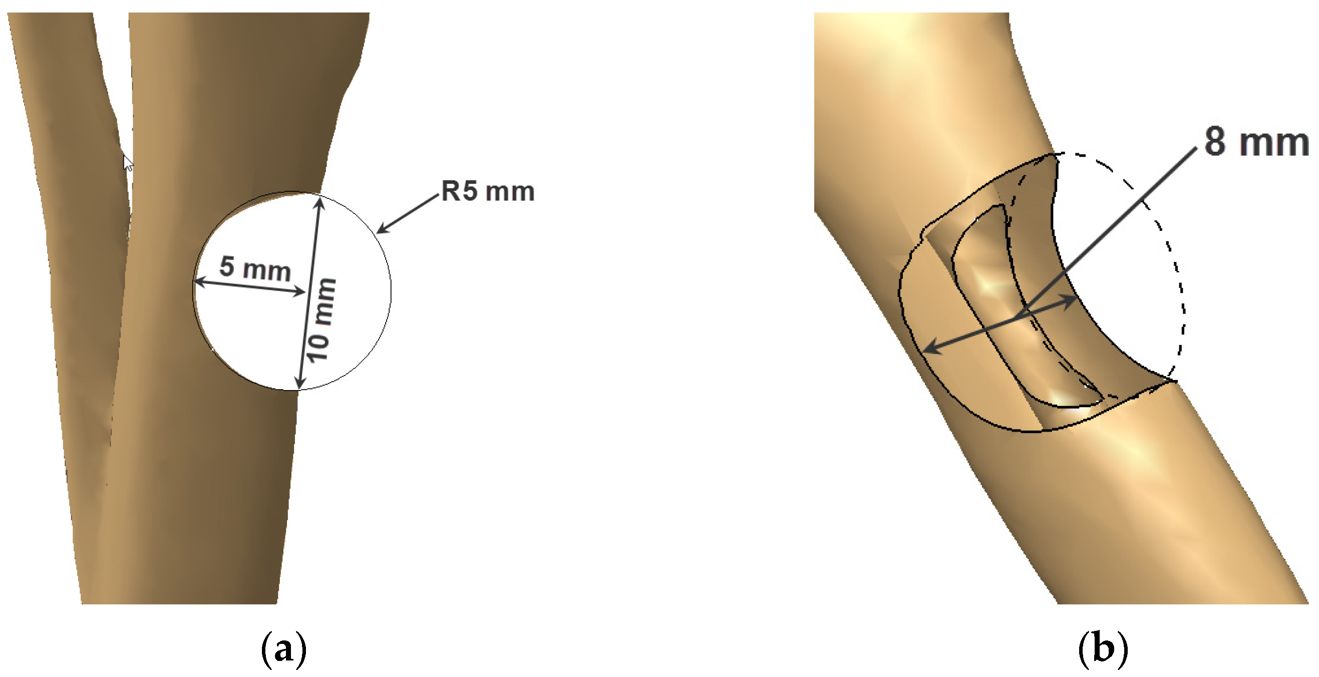 Metals 14 00219 g005