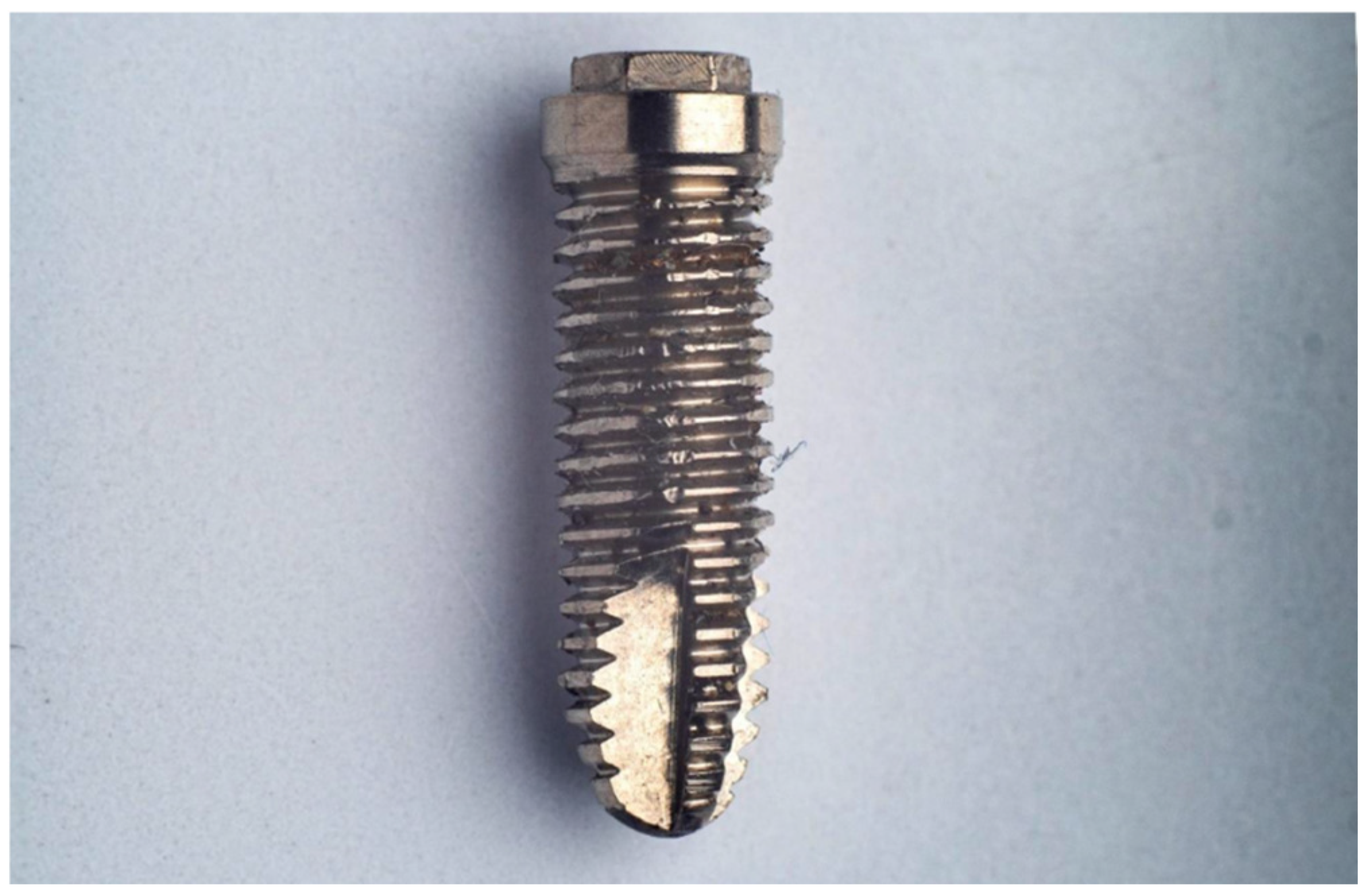 Metals 14 00816 g001