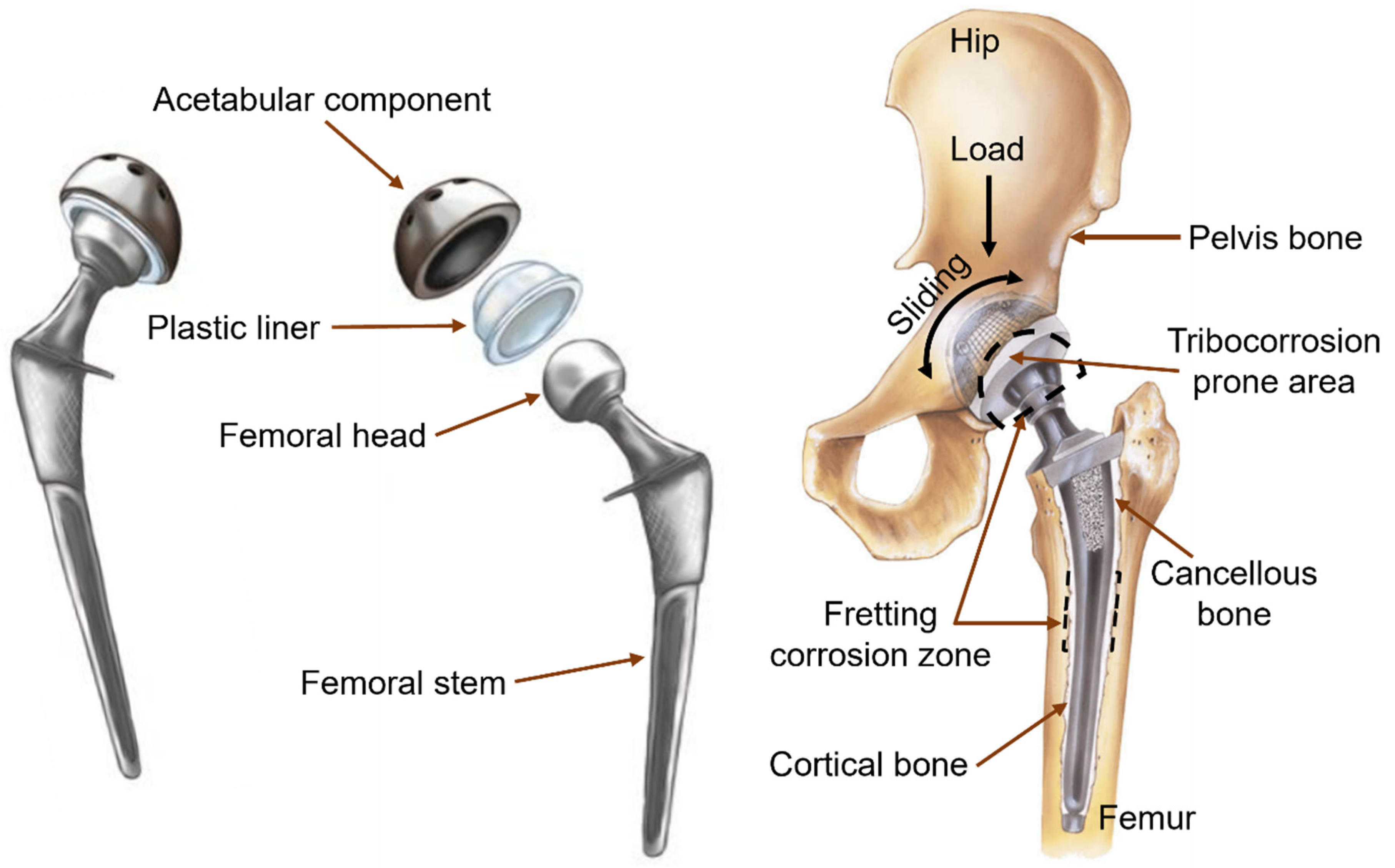 Metals 14 01334 g002