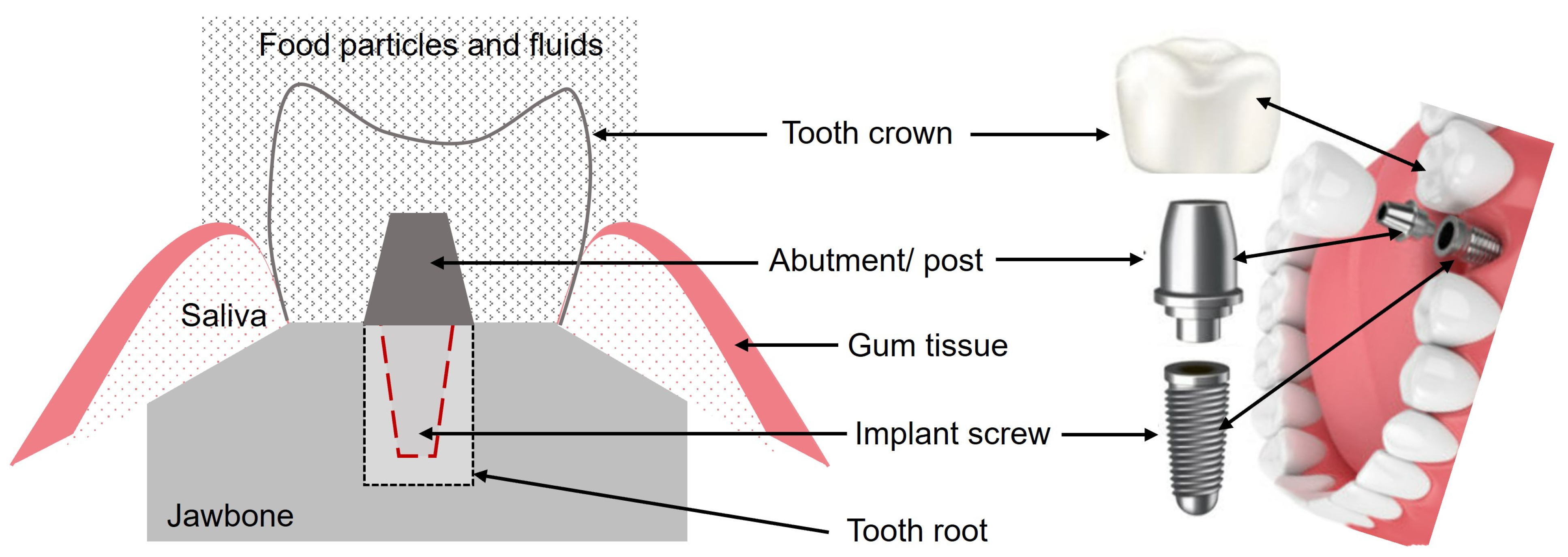 Metals 14 01334 g003