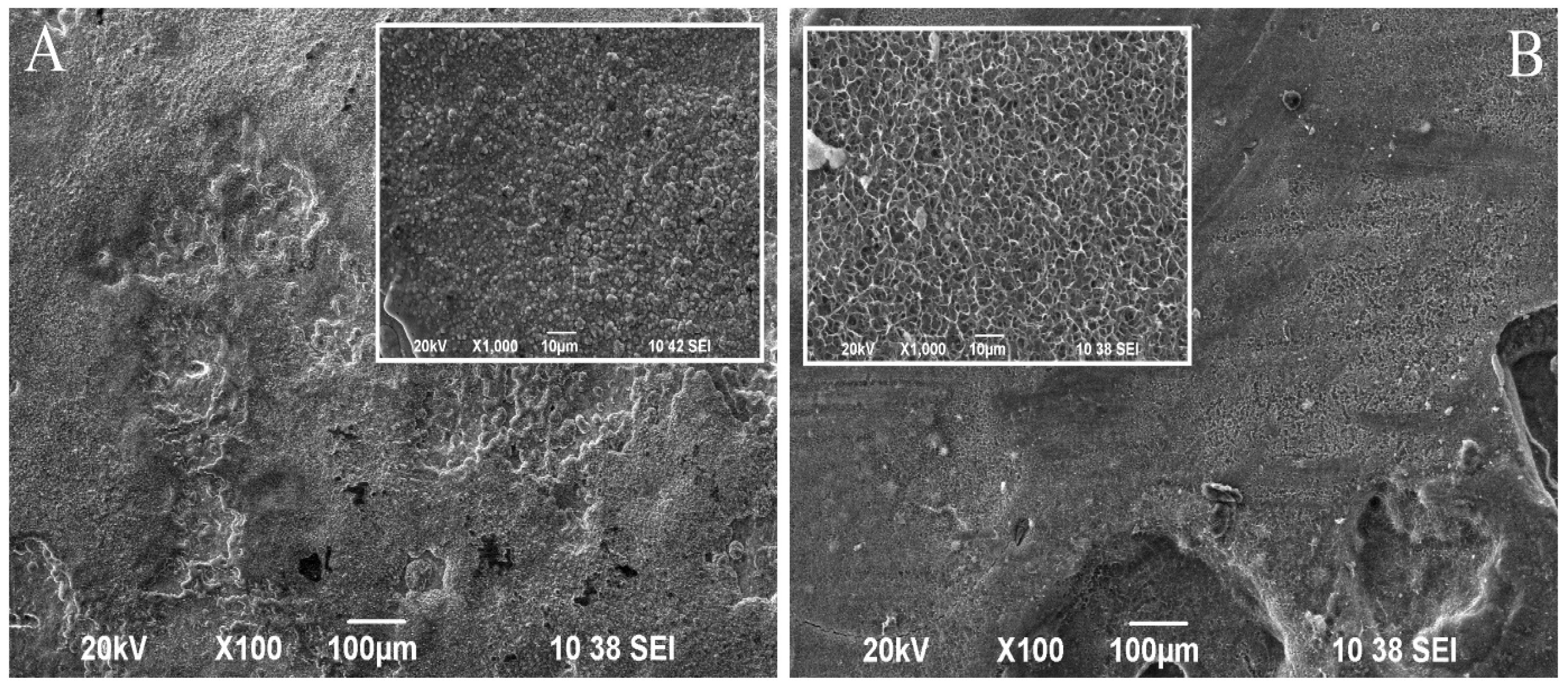 Metals 15 00065 g003