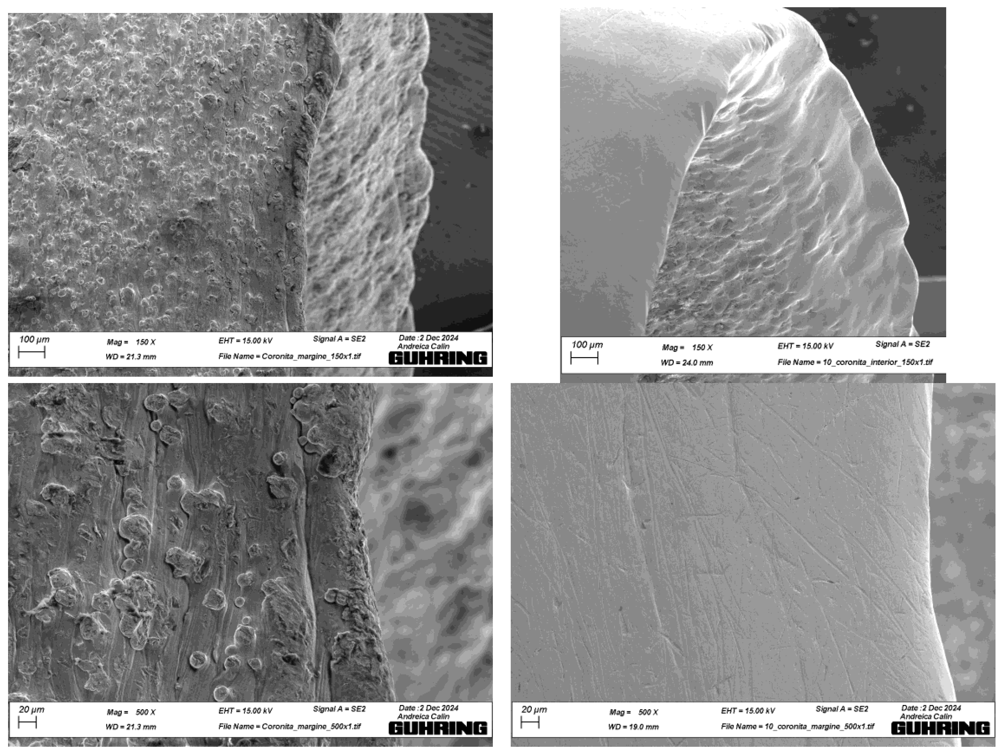 Metals 15 00471 g013a