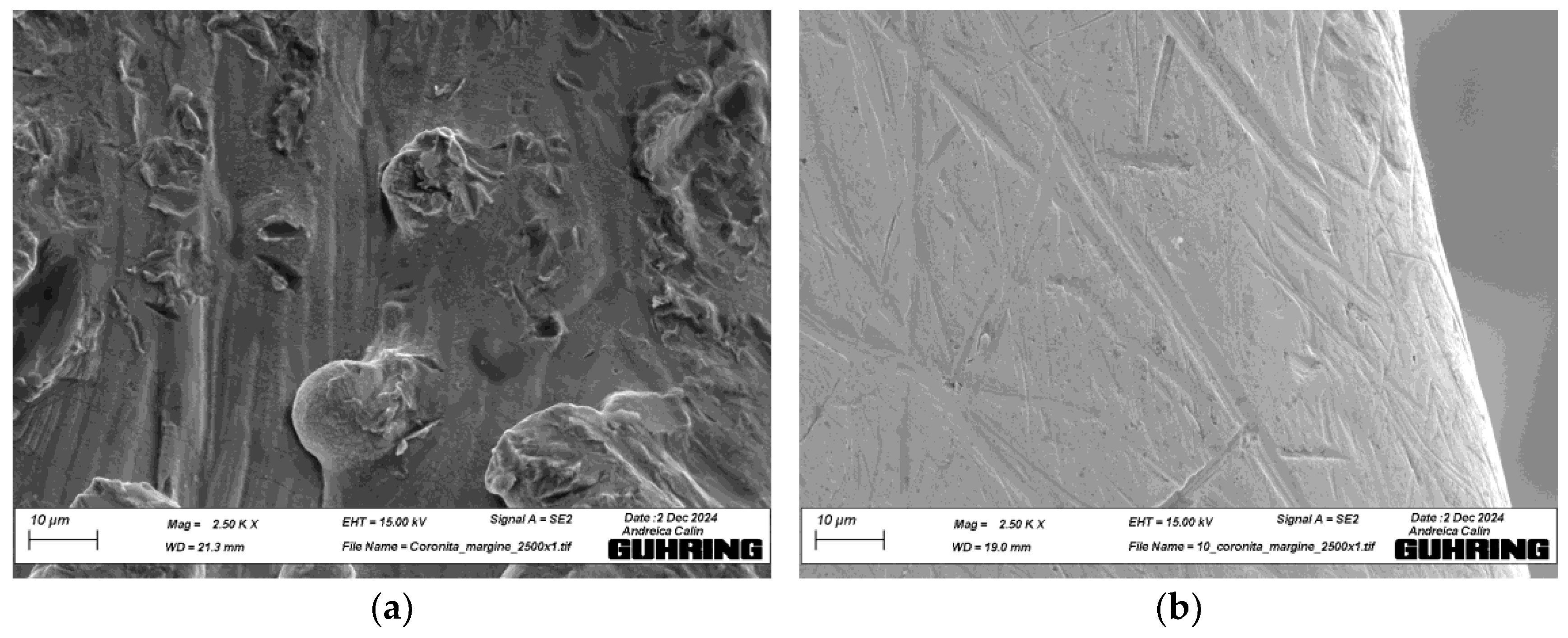 Metals 15 00471 g013b