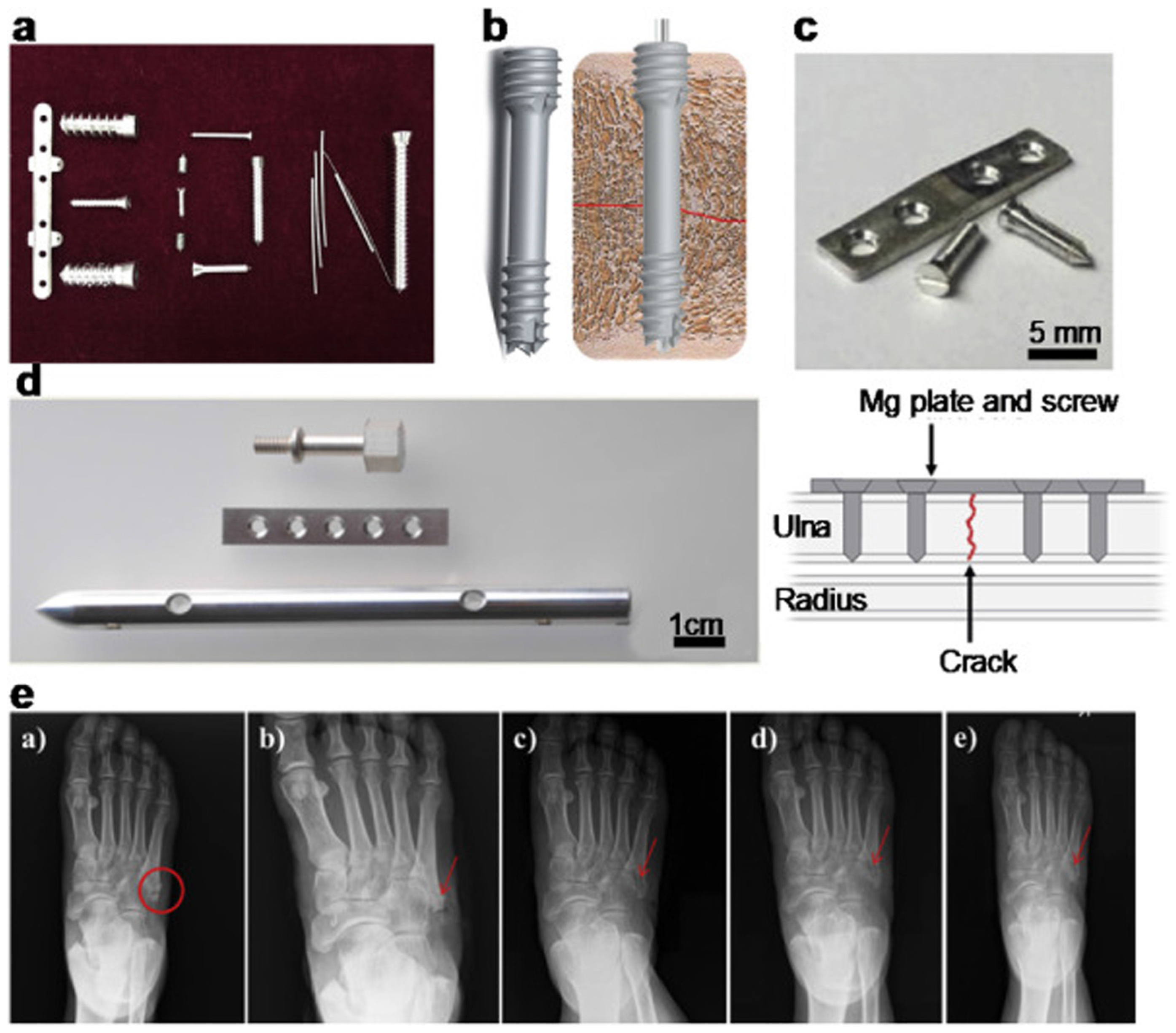 Metals 15 00475 g001