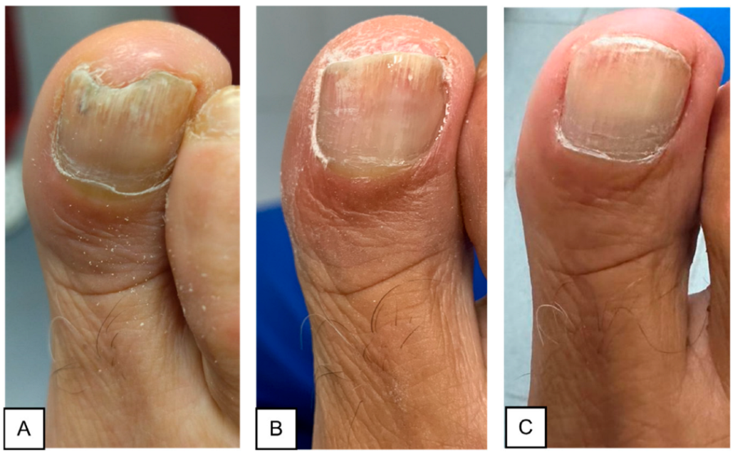 Microbiolres 16 00051 g003