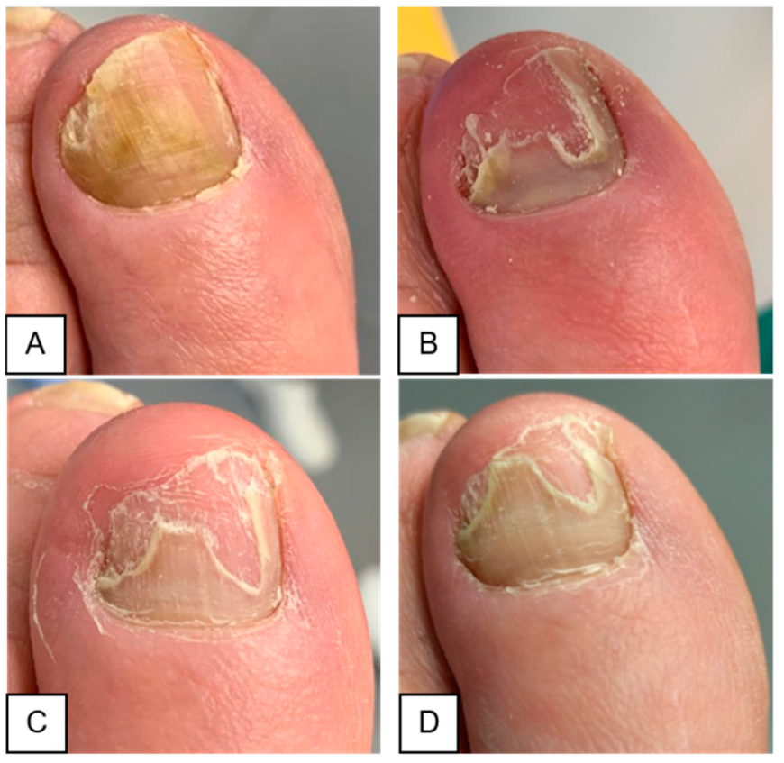 Microbiolres 16 00051 g004