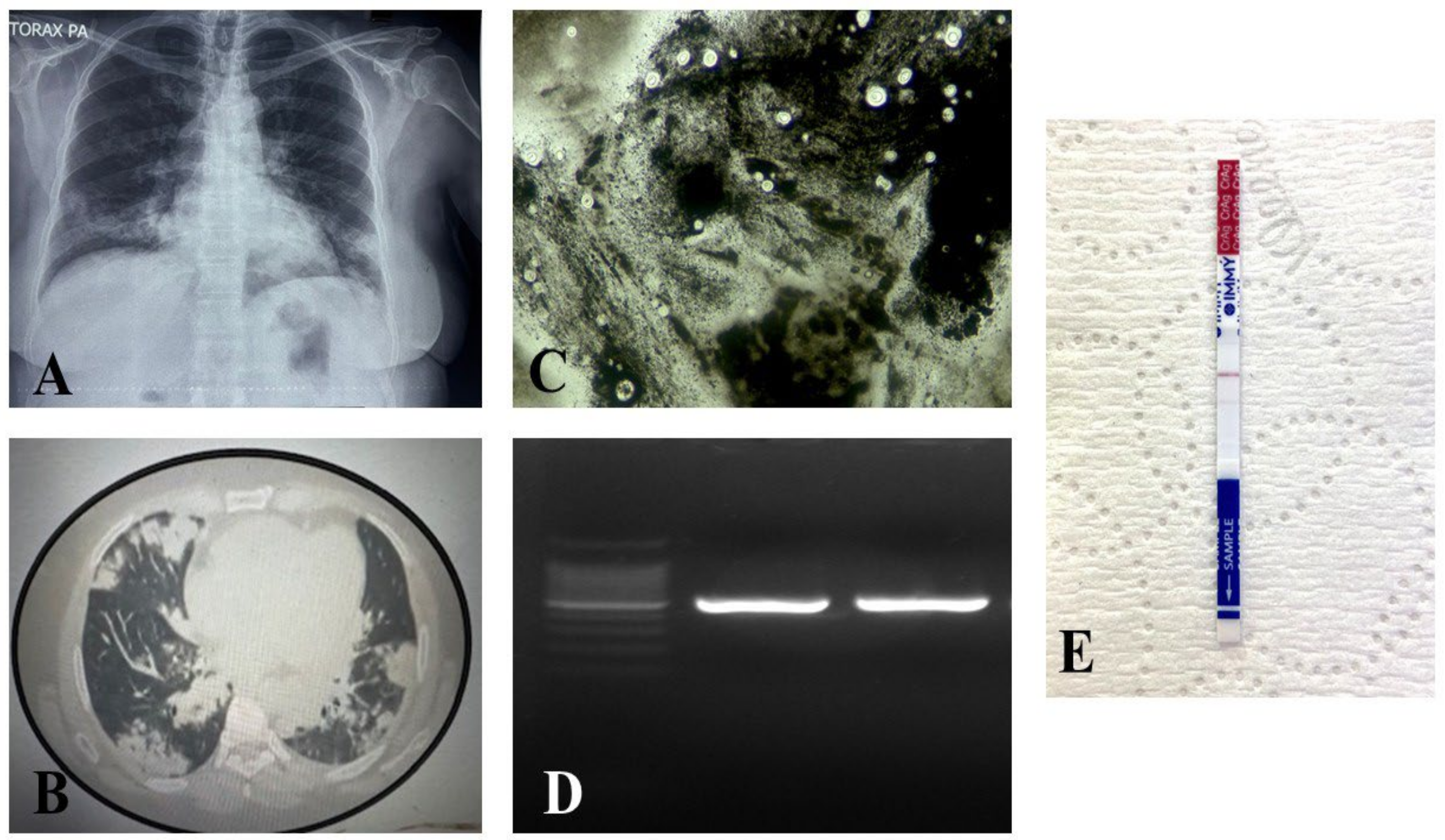 Microbiolres 16 00245 g001