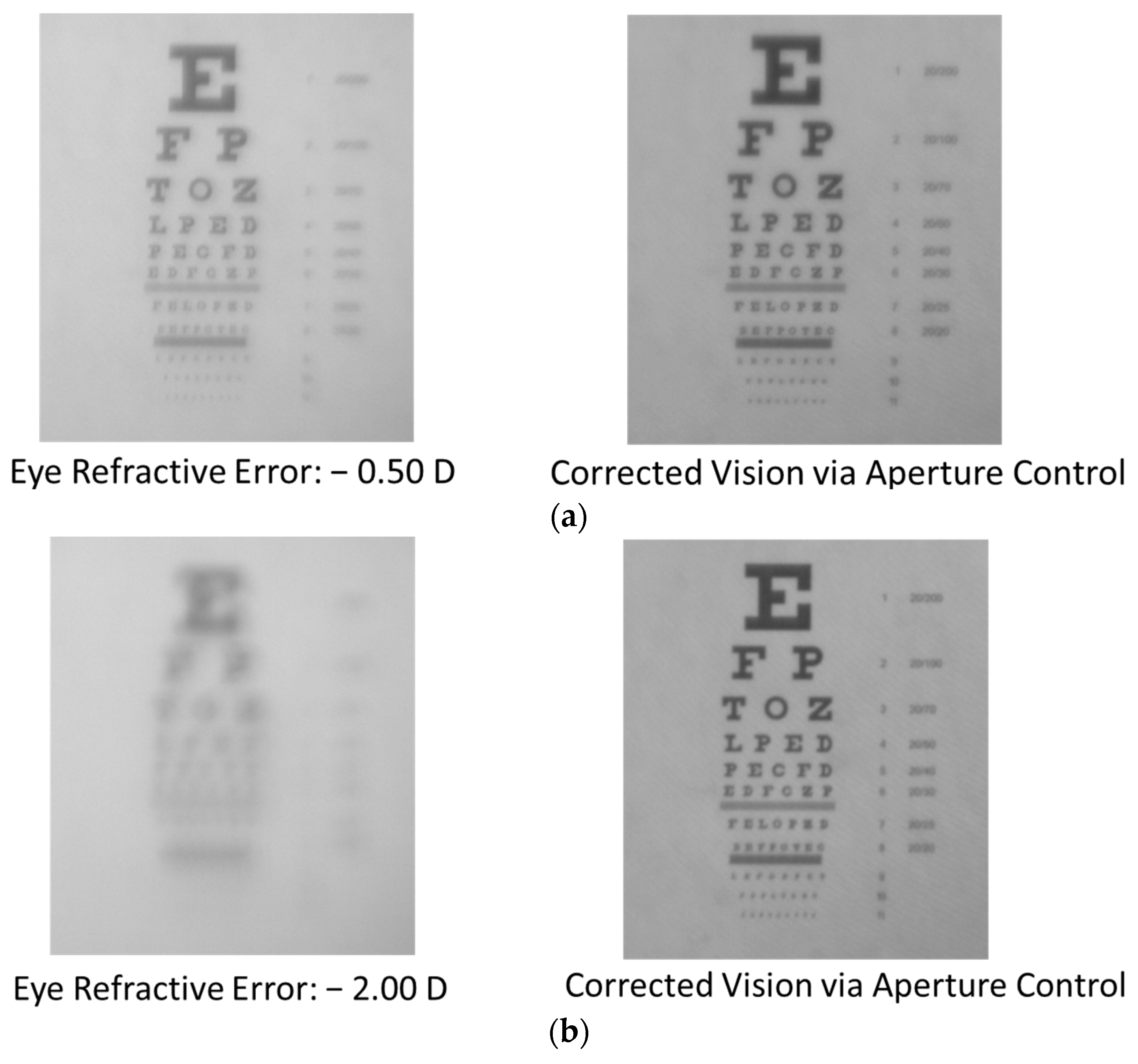 Can 20 400 Vision Be Corrected Micromachines | Free Full-Text | Eye Vision Testing System and Eyewear