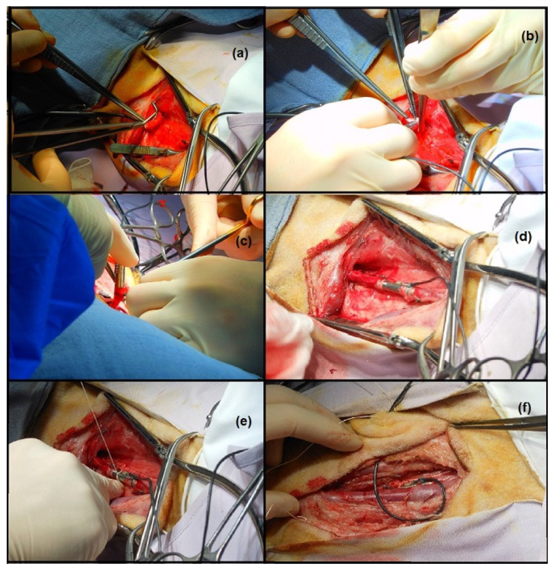 Micromachines 07 00135 g013 550