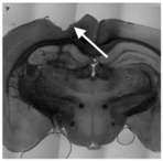 Micromachines 07 00179 i010