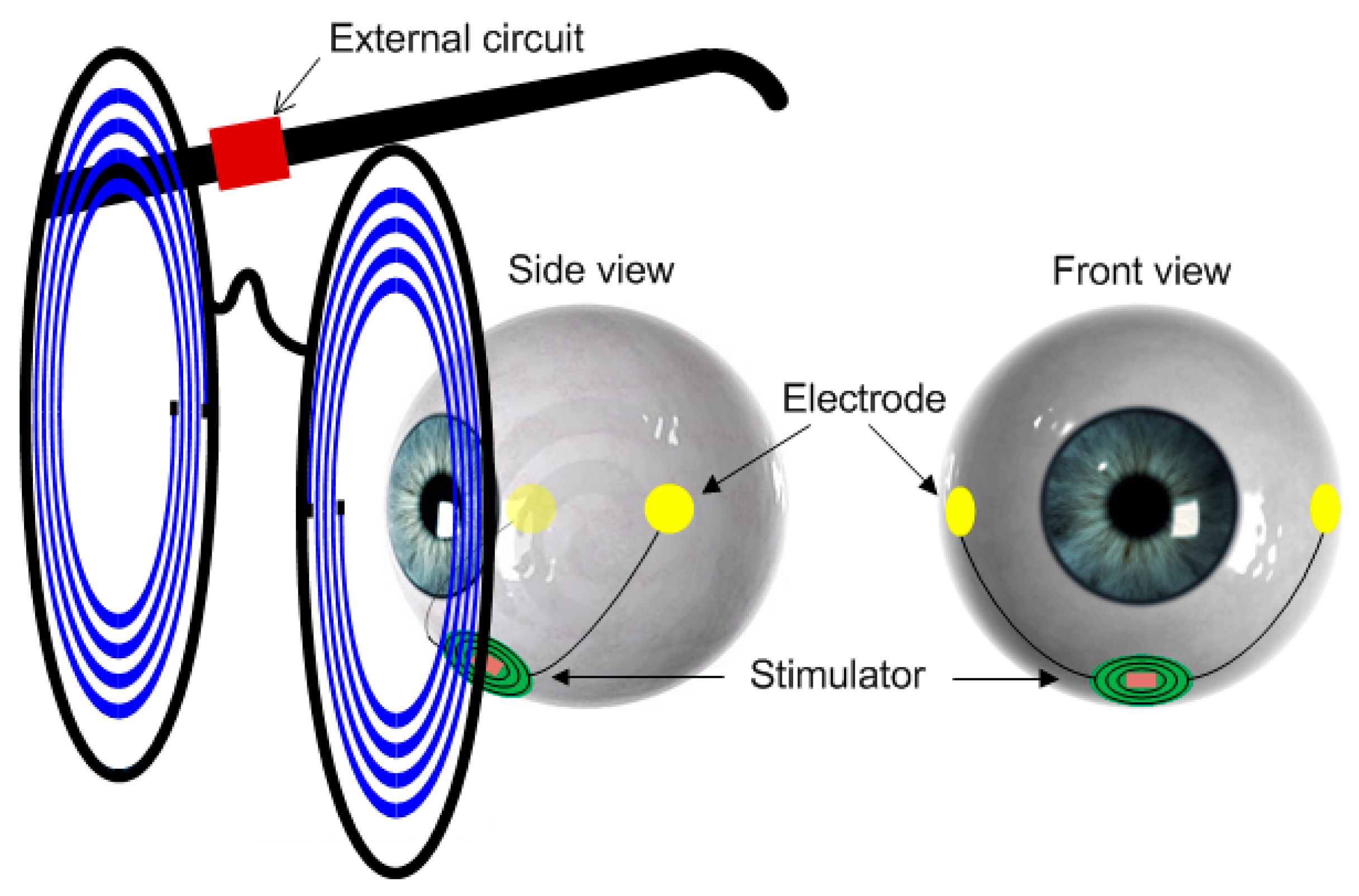 Micromachines 08 00368 g001 550
