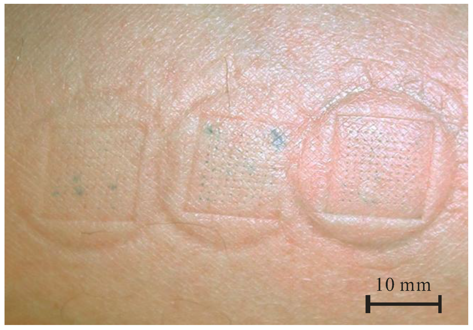 Micromachines 09 00040 g003 Micromachines 09 00040 g003