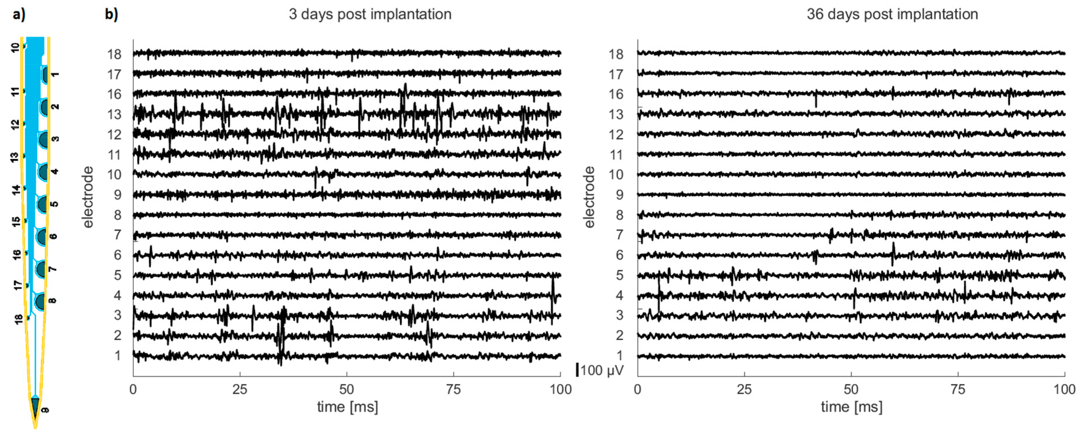 Micromachines 09 00131 g011