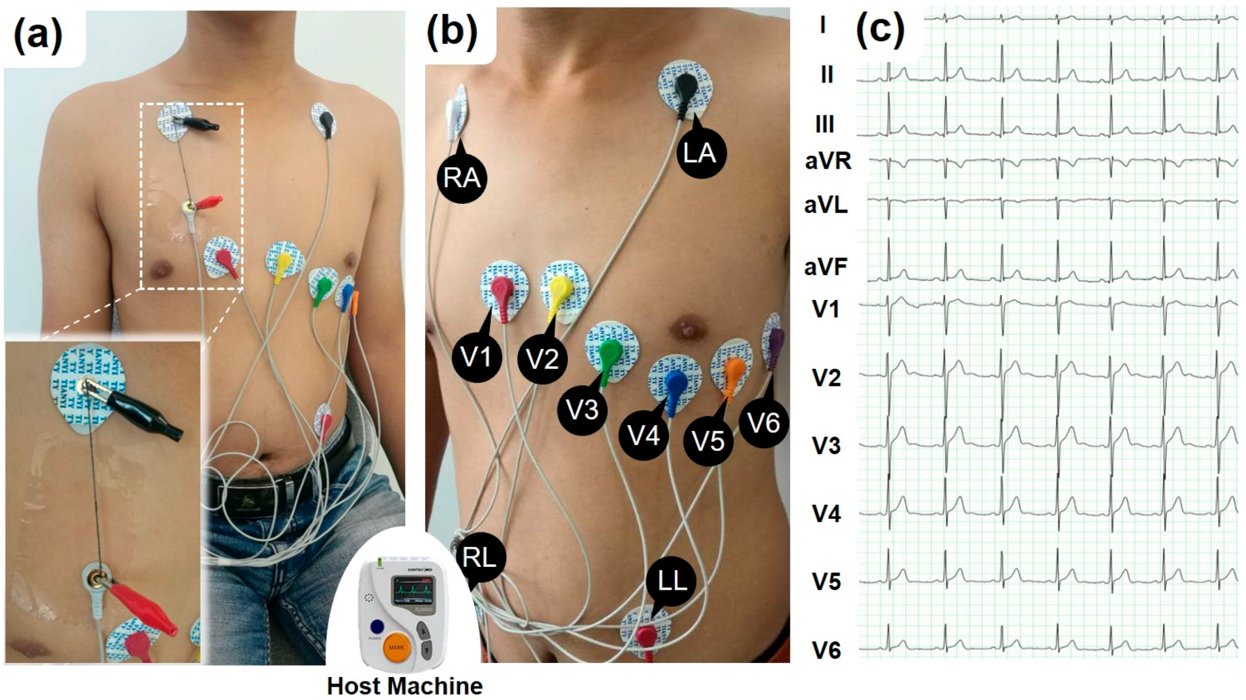 Micromachines 09 00132 g002 Micromachines 09 00132 g002