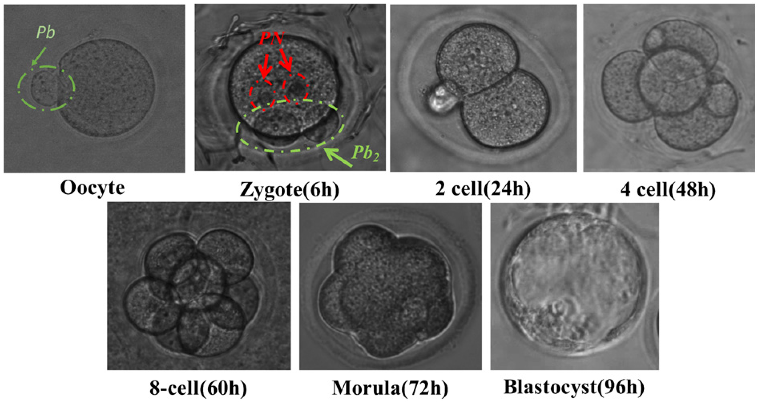 Micromachines 09 00135 g004