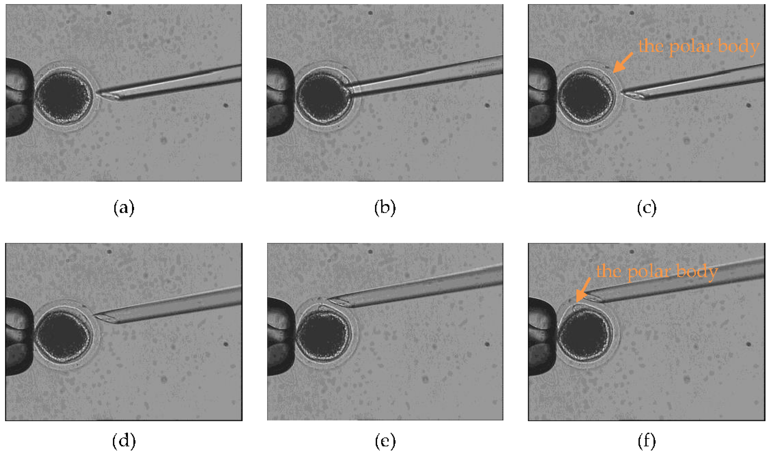 Micromachines 09 00141 g009 550