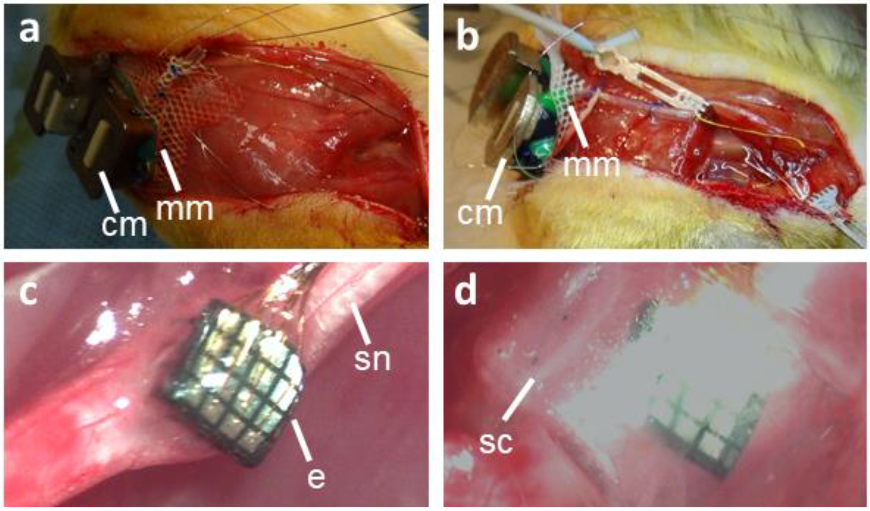 Micromachines 09 00587 g001
