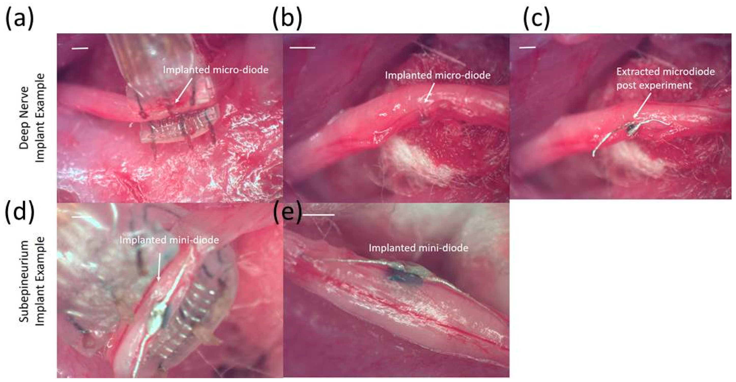 Micromachines 09 00595 g012